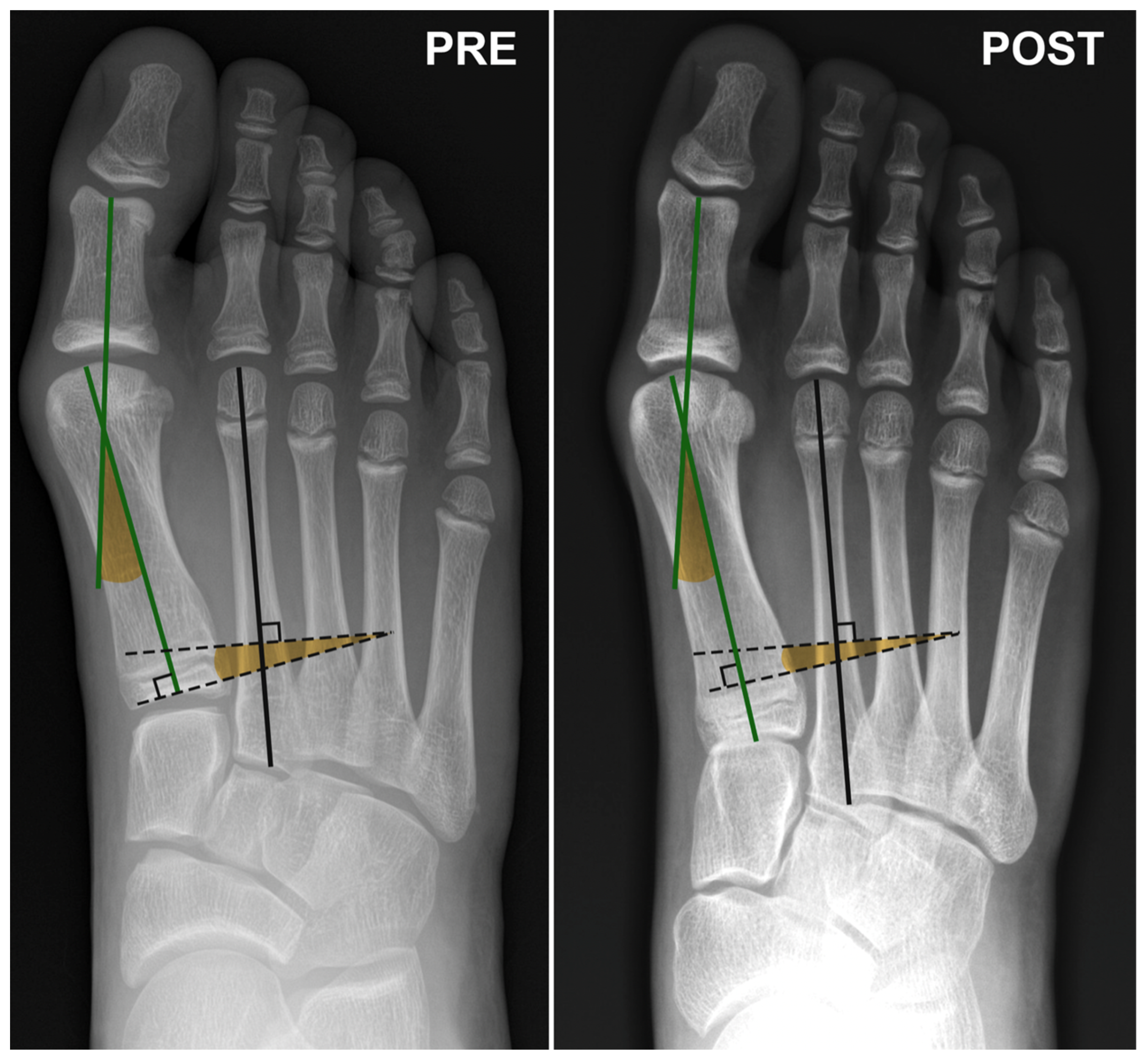 Children 11 00760 g001