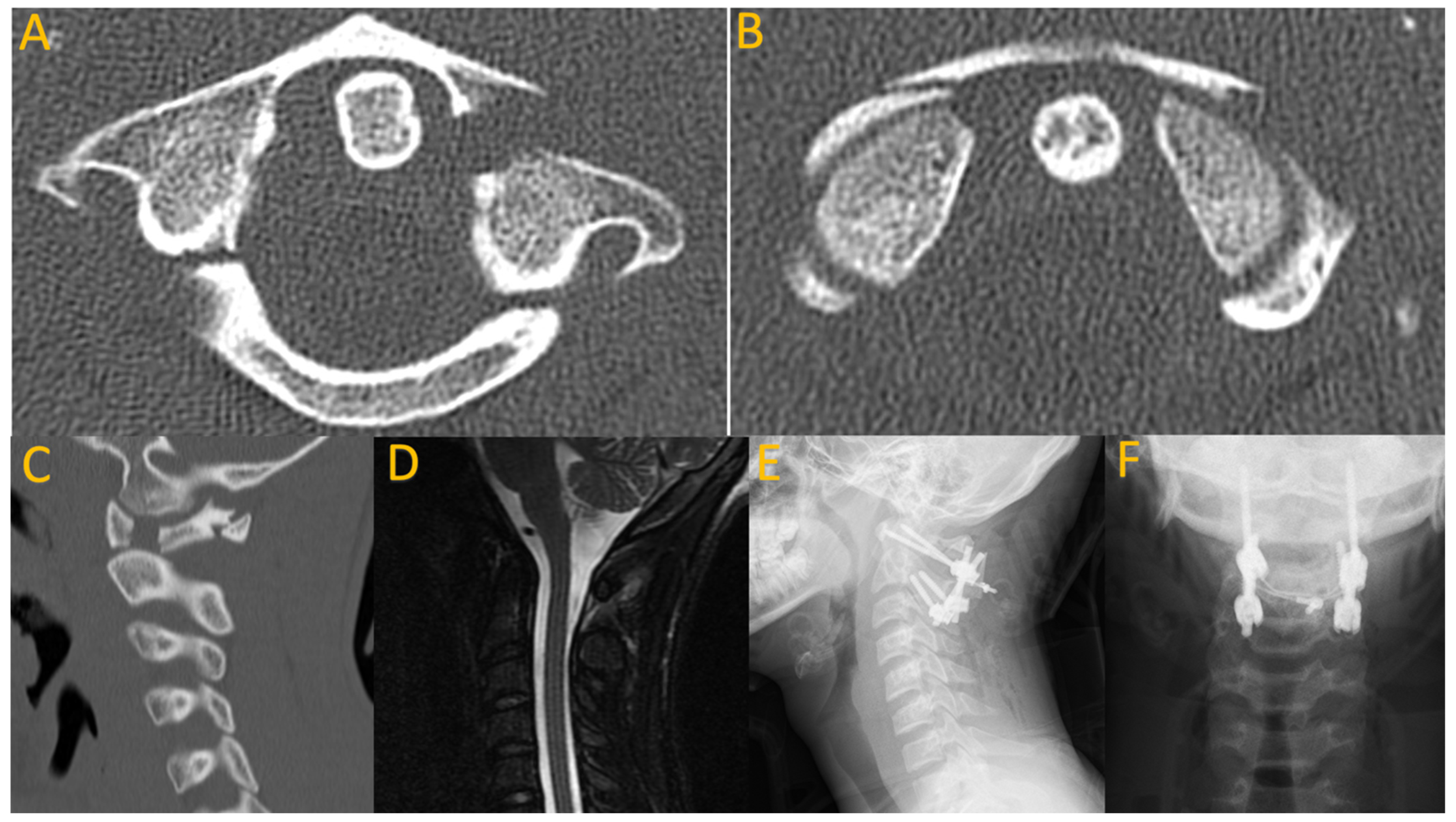 Children 11 00809 g001