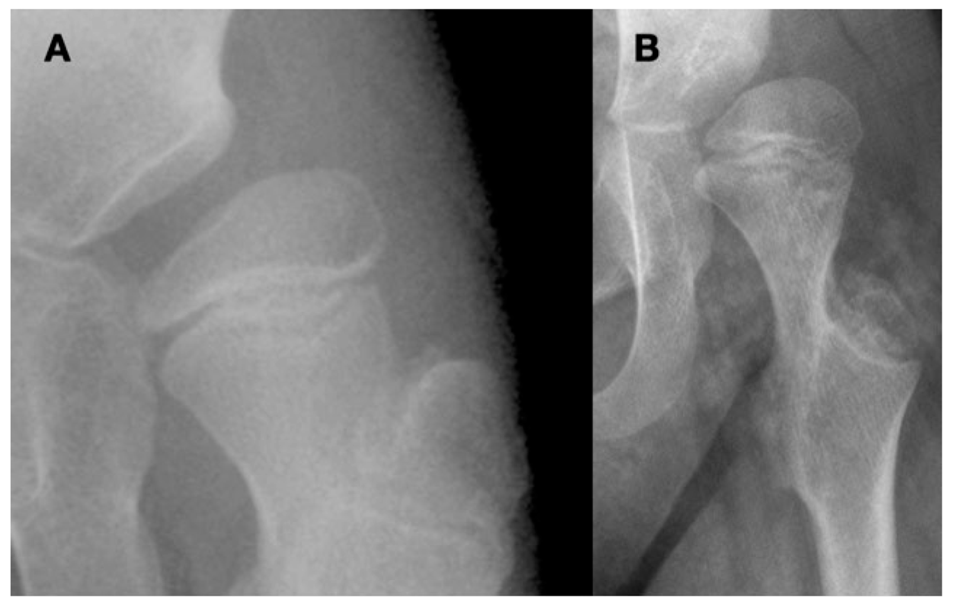 Children 11 00844 g002