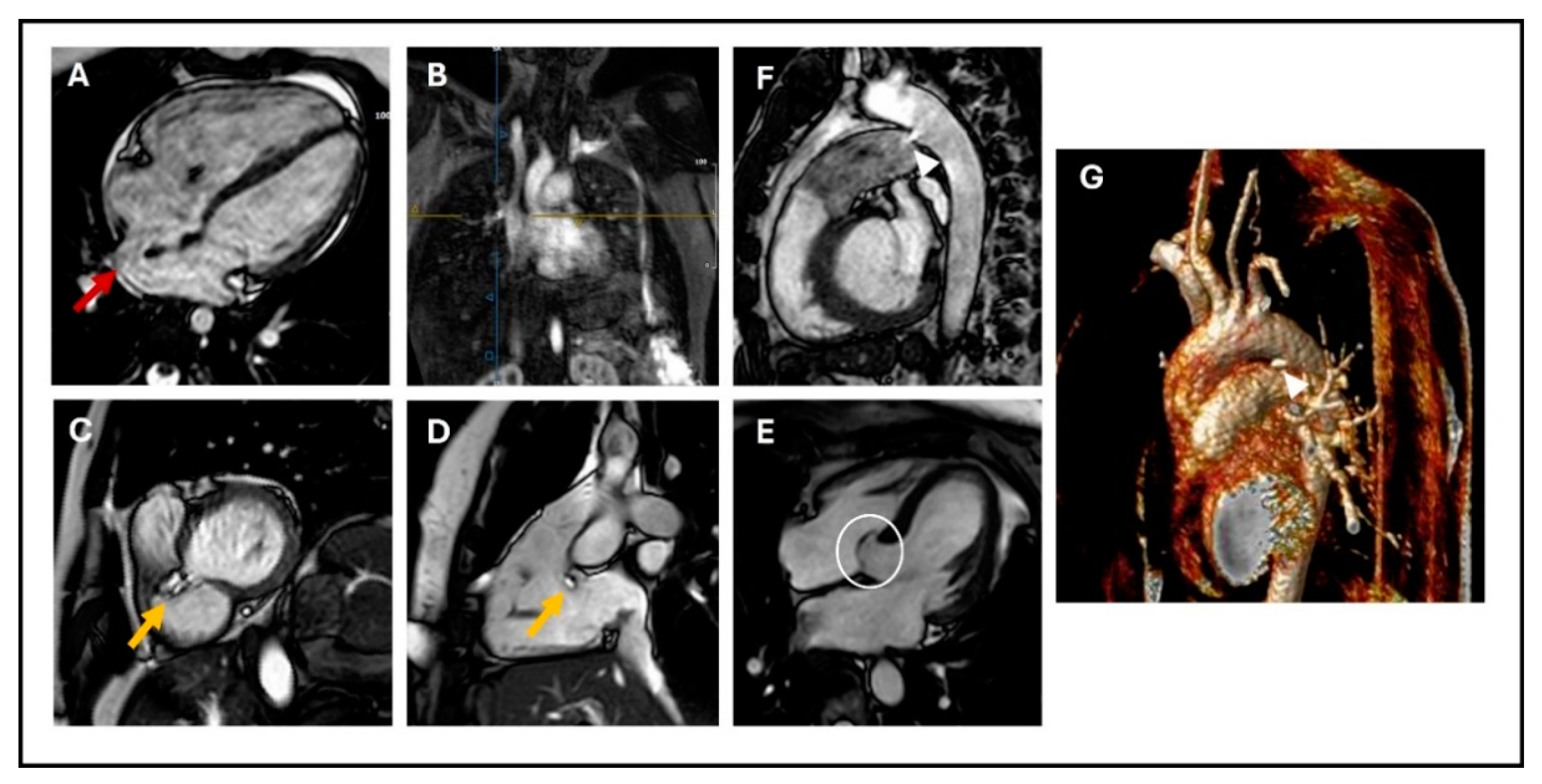 Children 11 00878 g001
