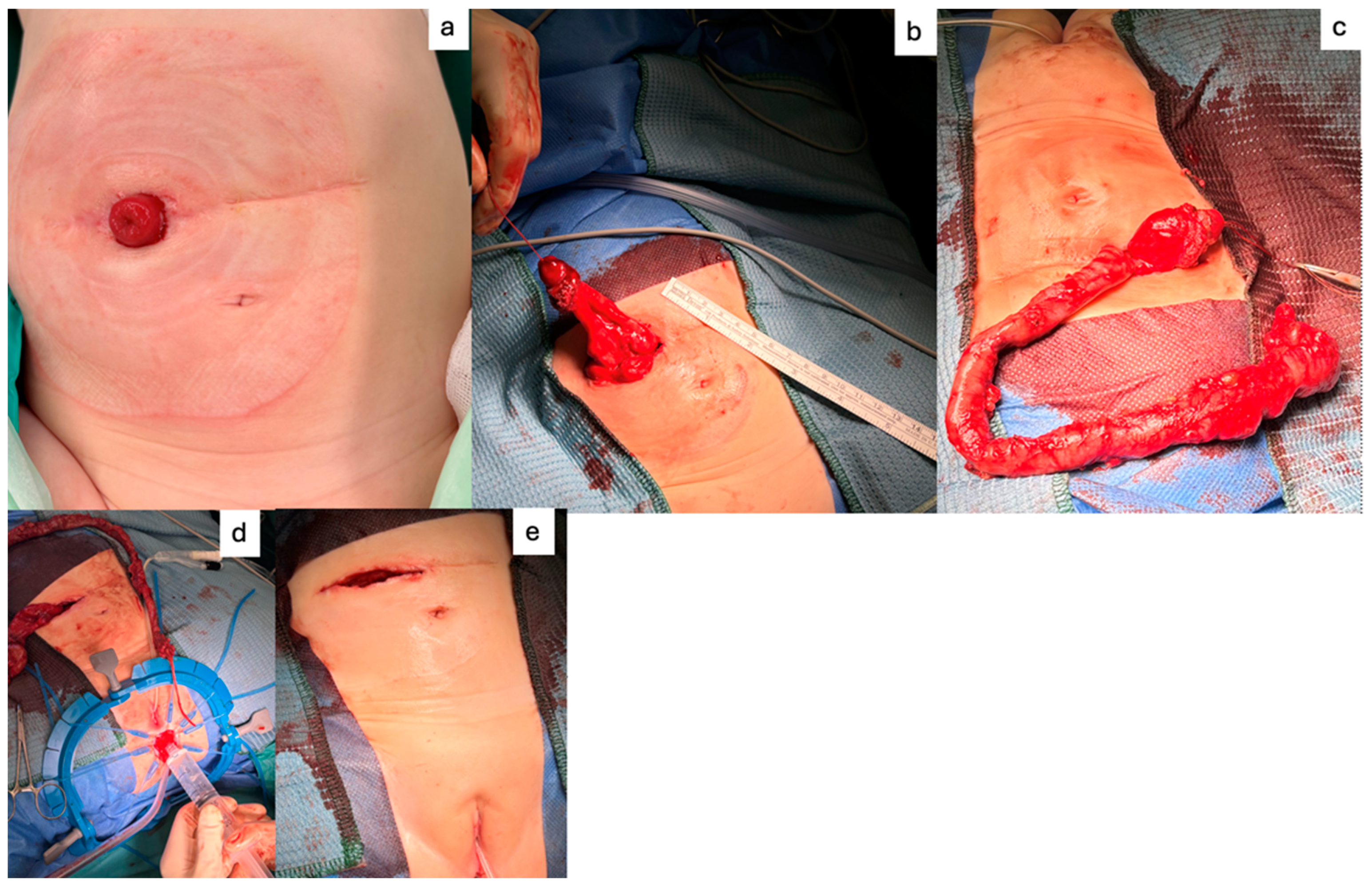 Children 11 00911 g003