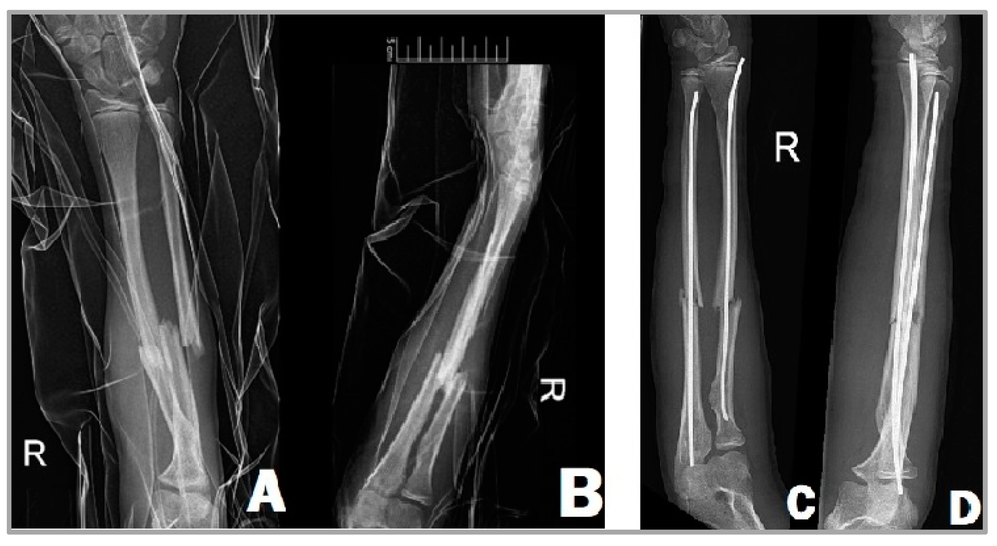 Children 11 00942 g001 Children 11 00942 g001