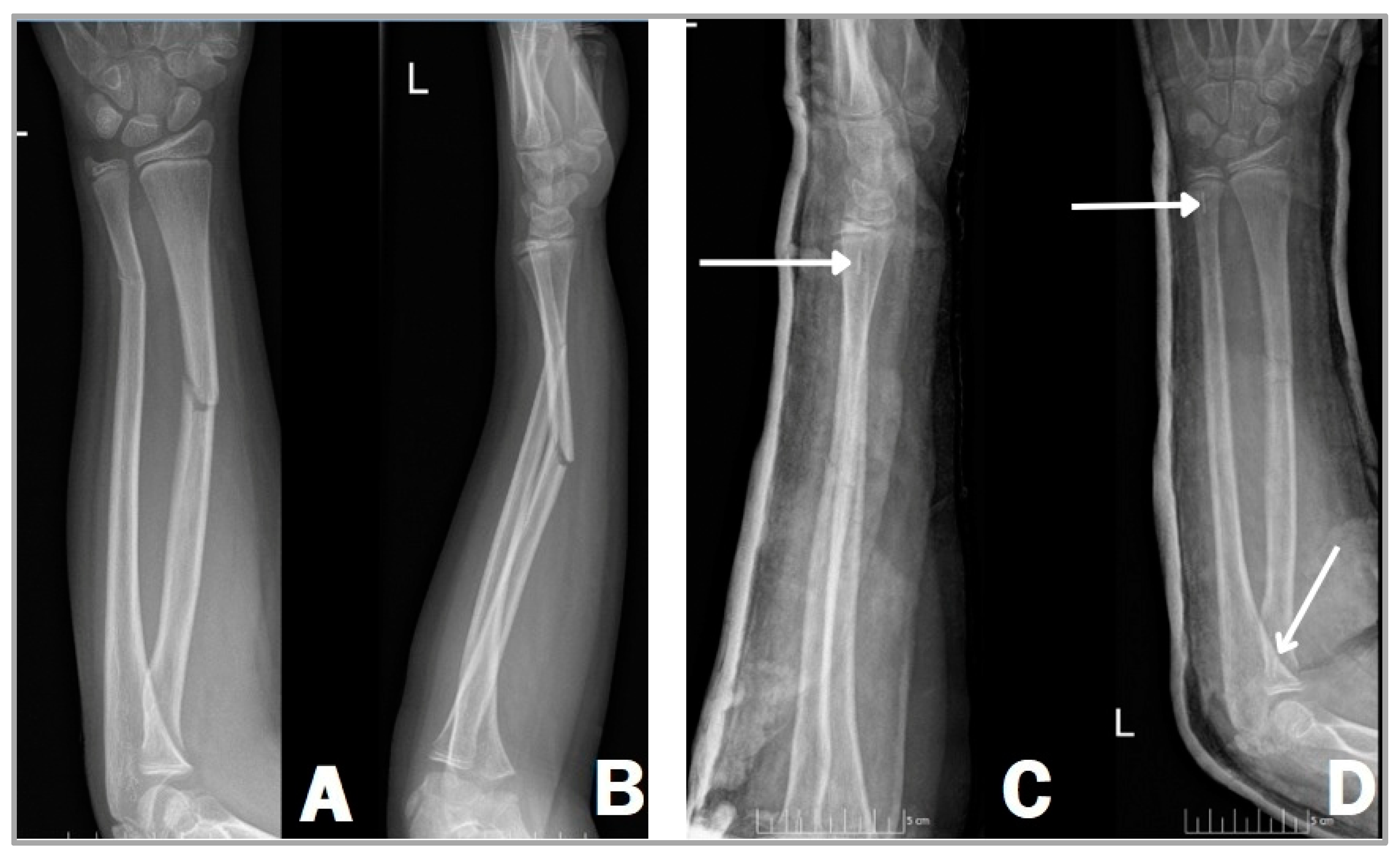 Children 11 00942 g002 Children 11 00942 g002