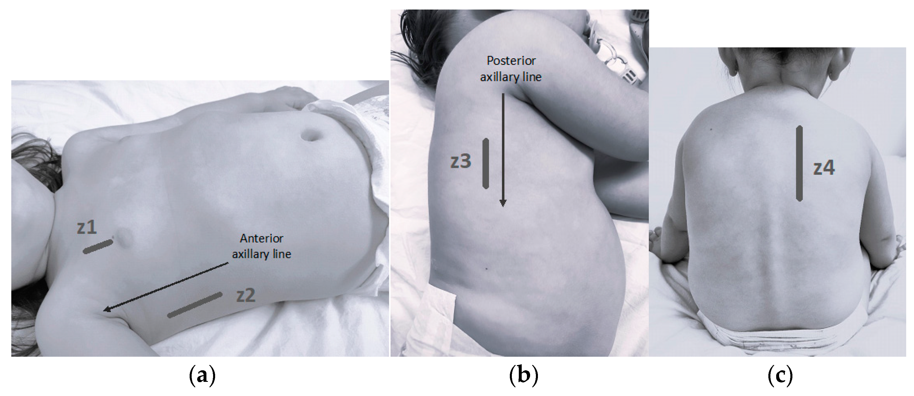 Children 11 00987 g001