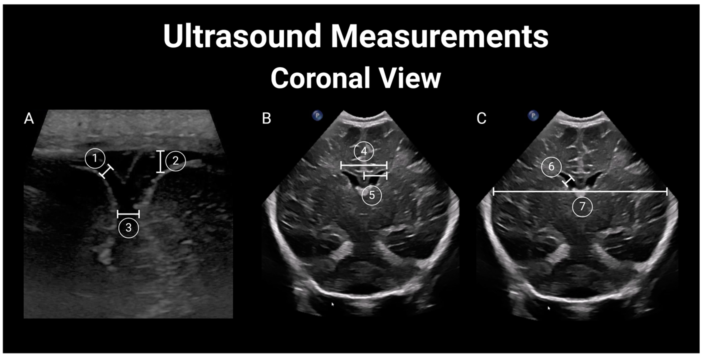 Children 11 01039 g002