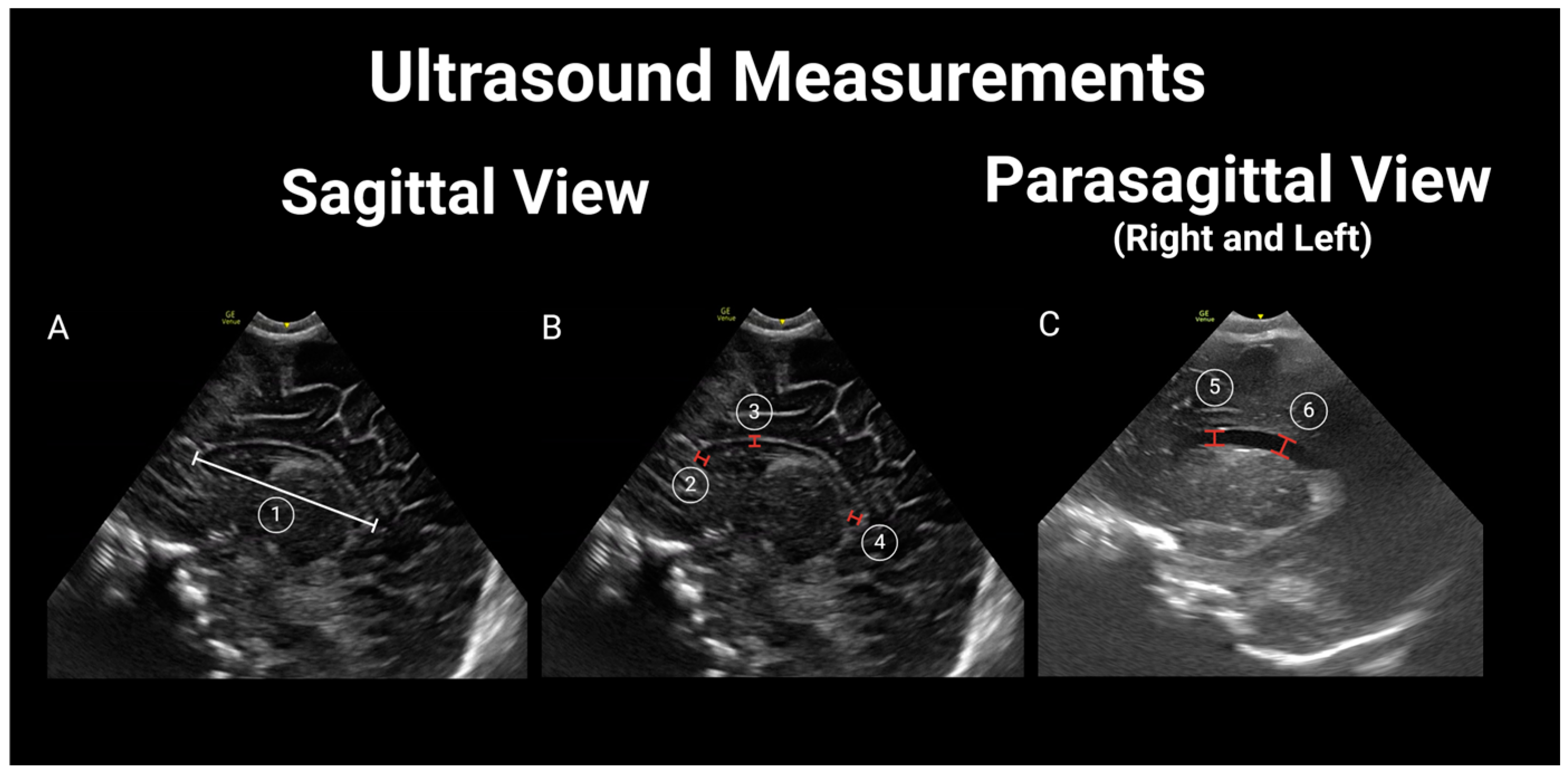Children 11 01039 g003