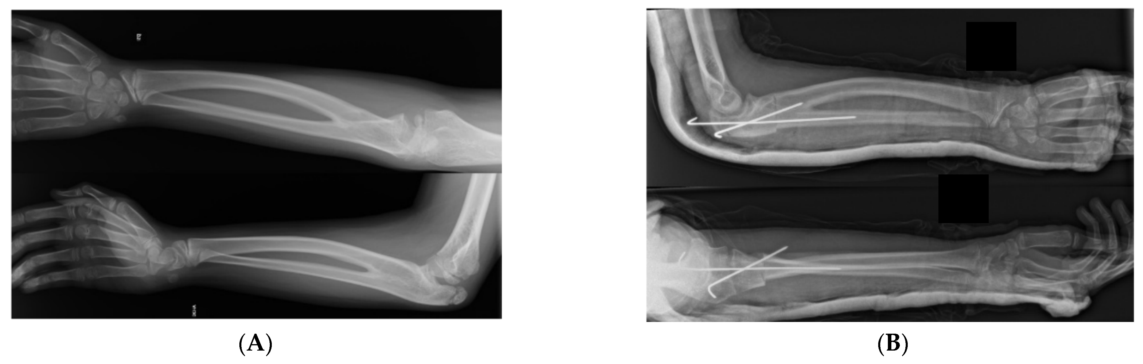 Children 11 01317 g001