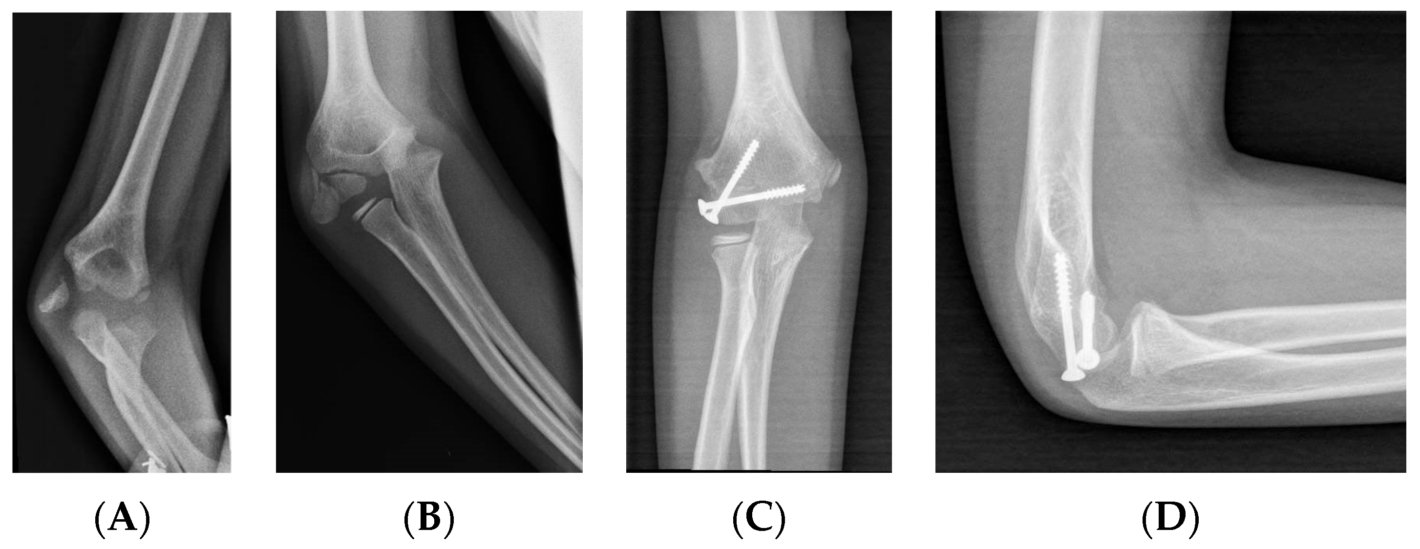 Children 11 01421 g004