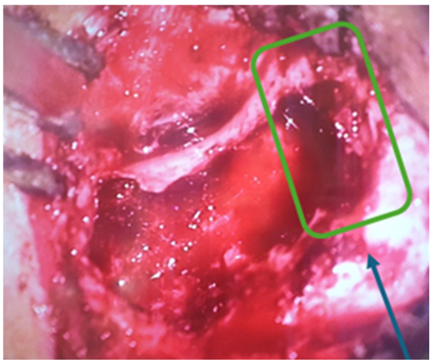 Children 11 01496 g004