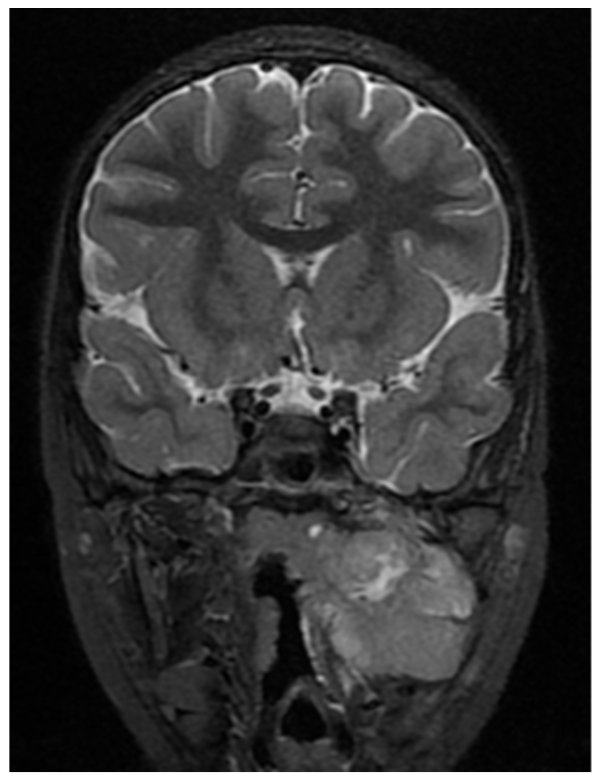 Children 11 01496 g006