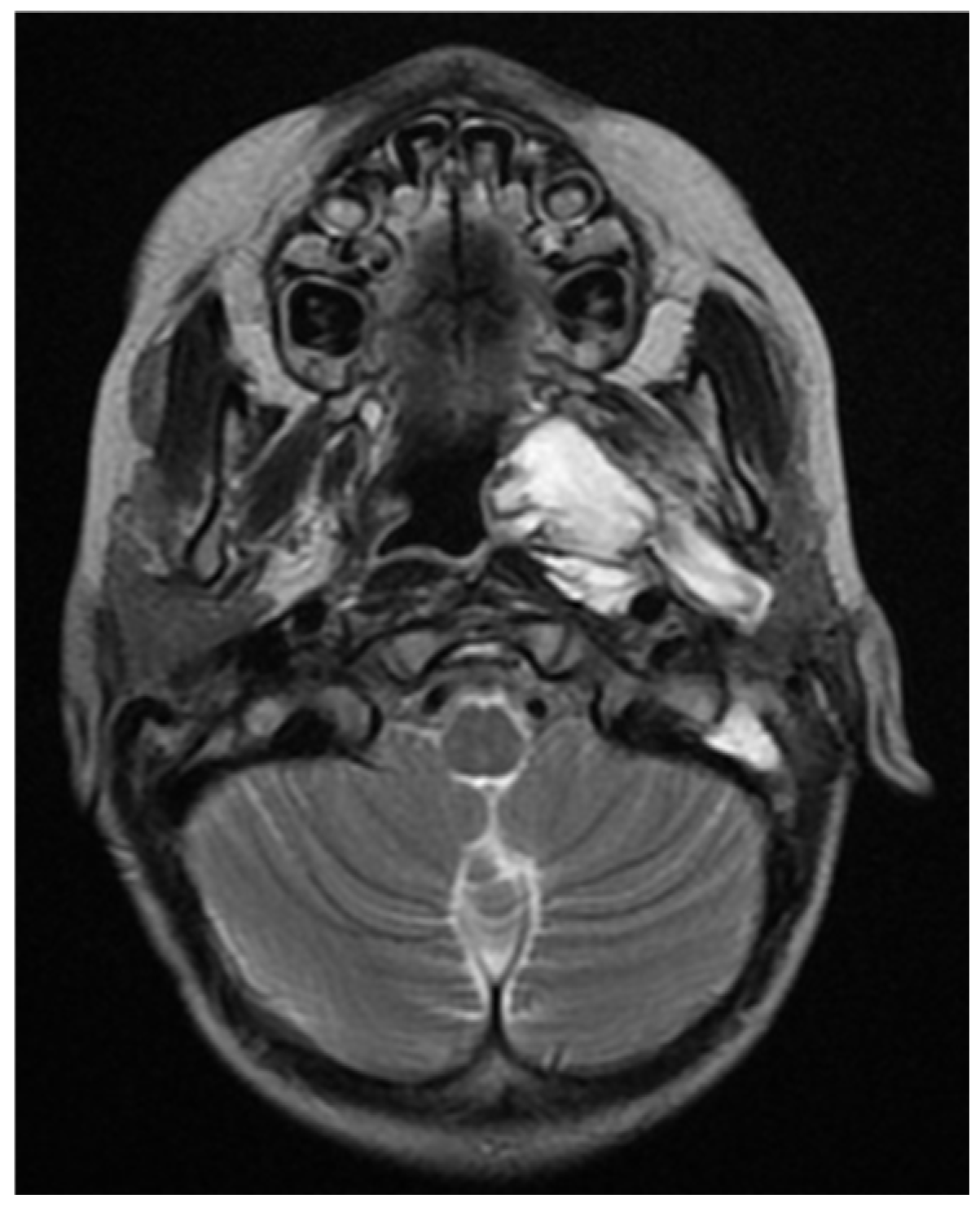 Children 11 01496 g011