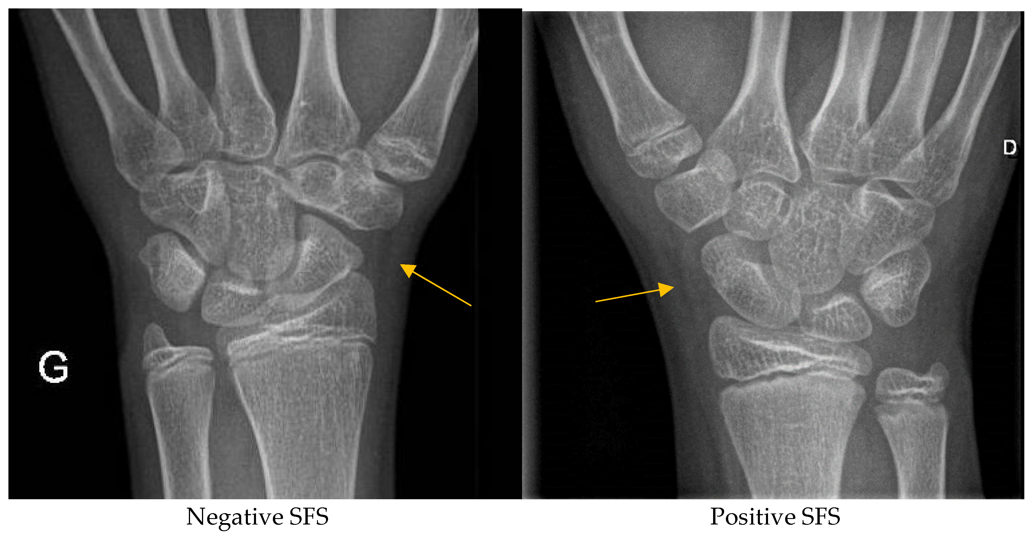 Children 12 00086 g002