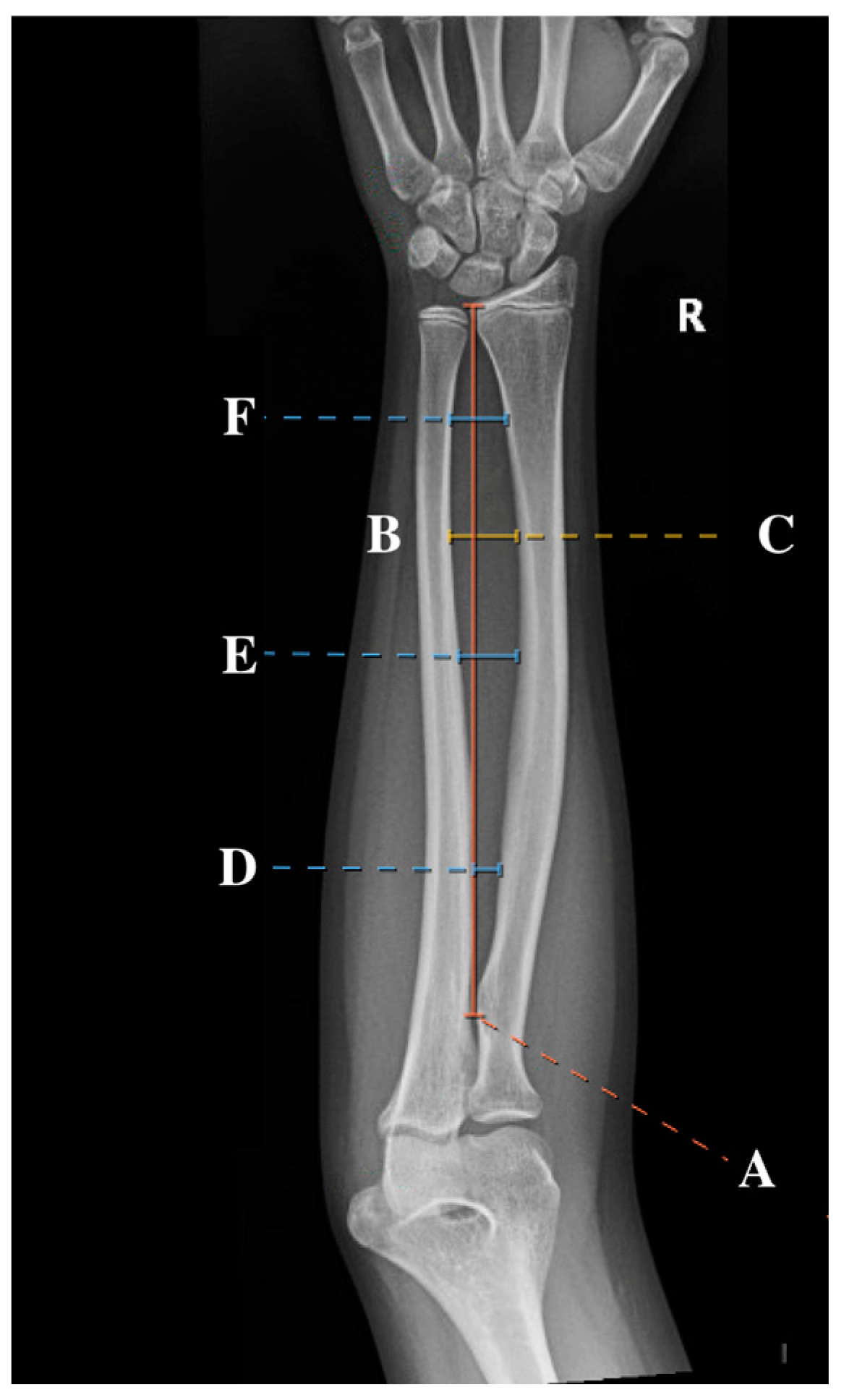 Children 12 00101 g001