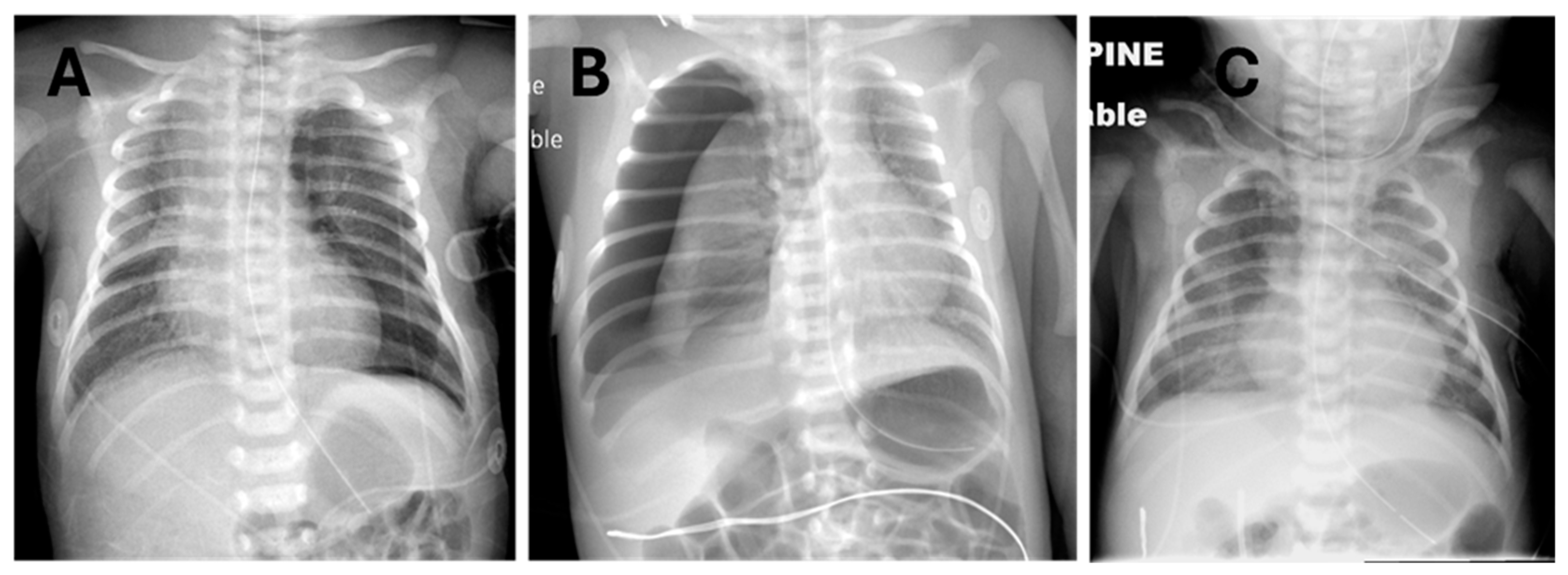 Children 12 00134 g001