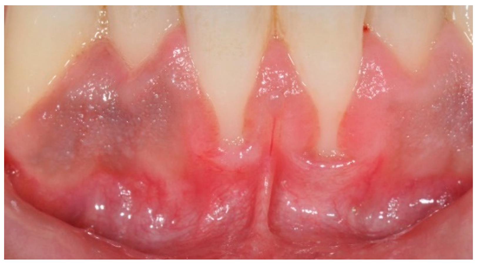 Children 12 00138 g001