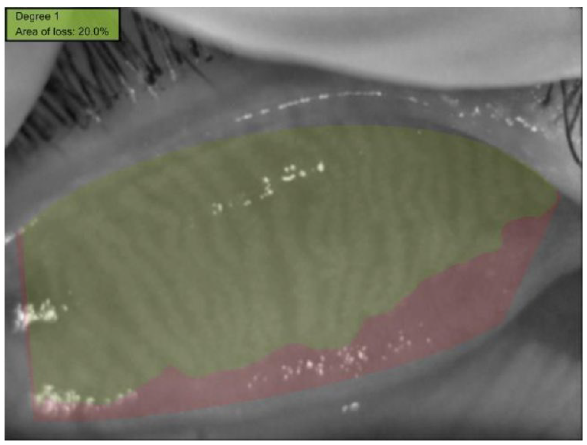 Children 12 00150 g004