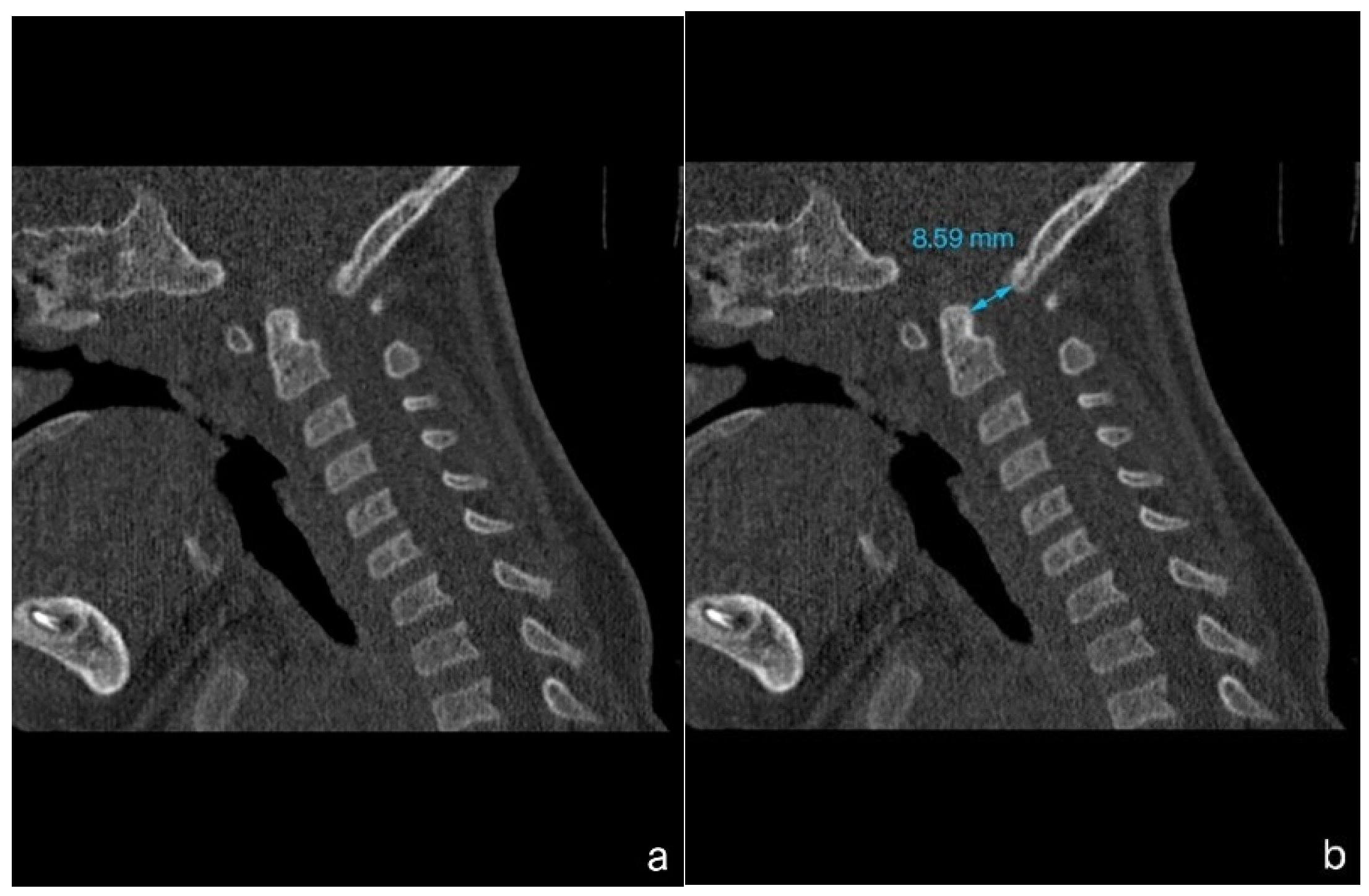 Children 12 00164 g001
