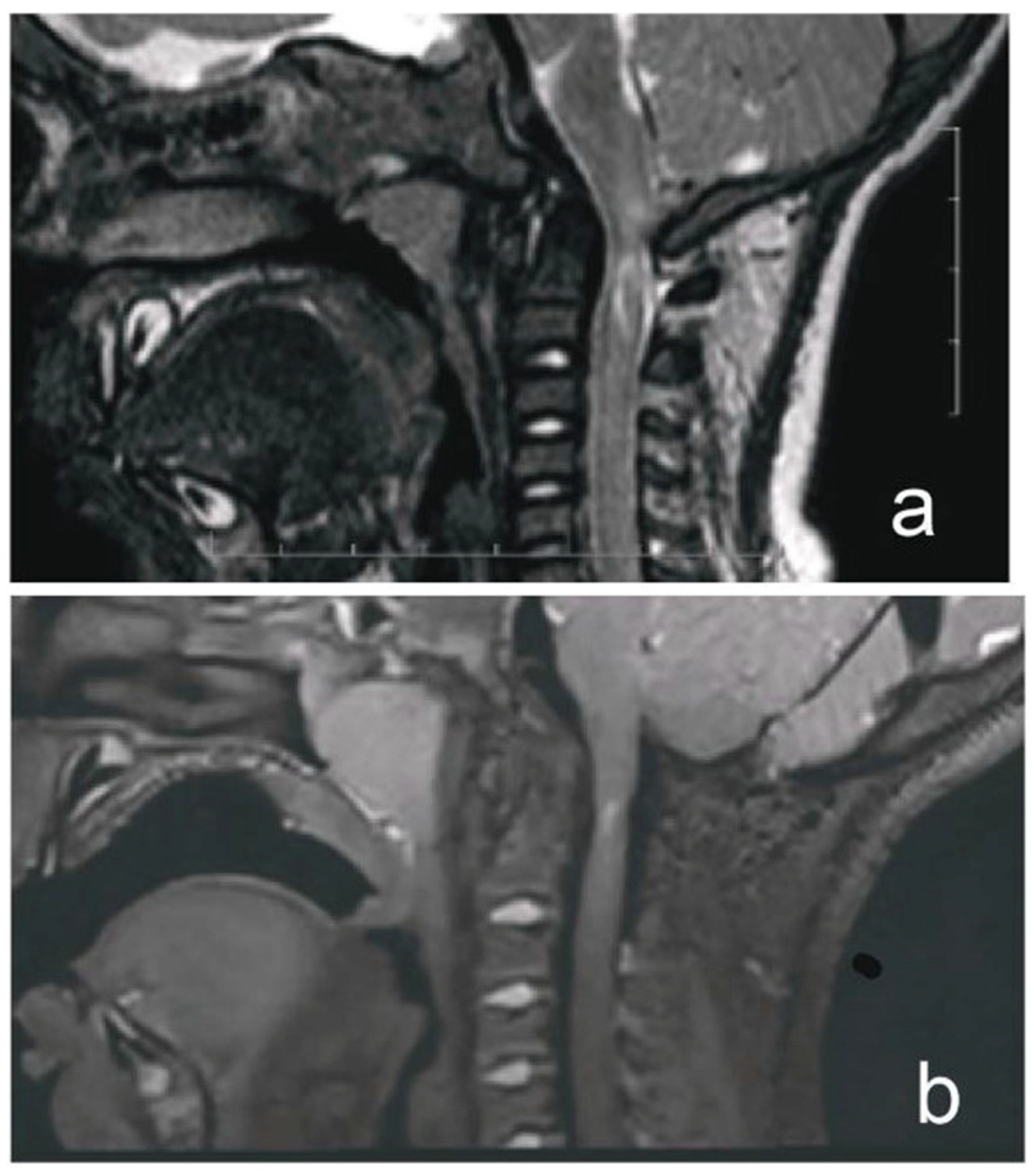 Children 12 00164 g002