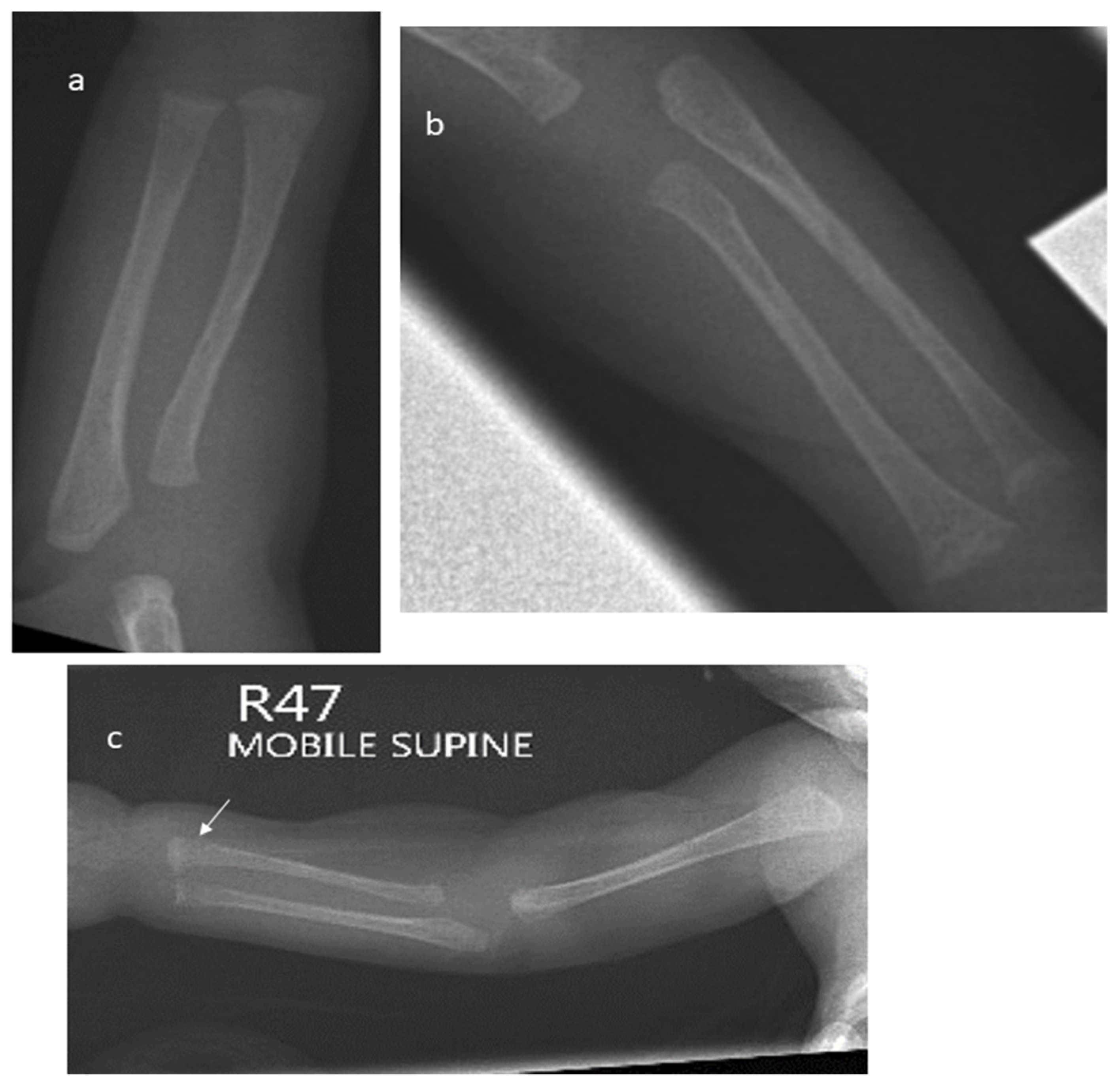 Children 12 00172 g001