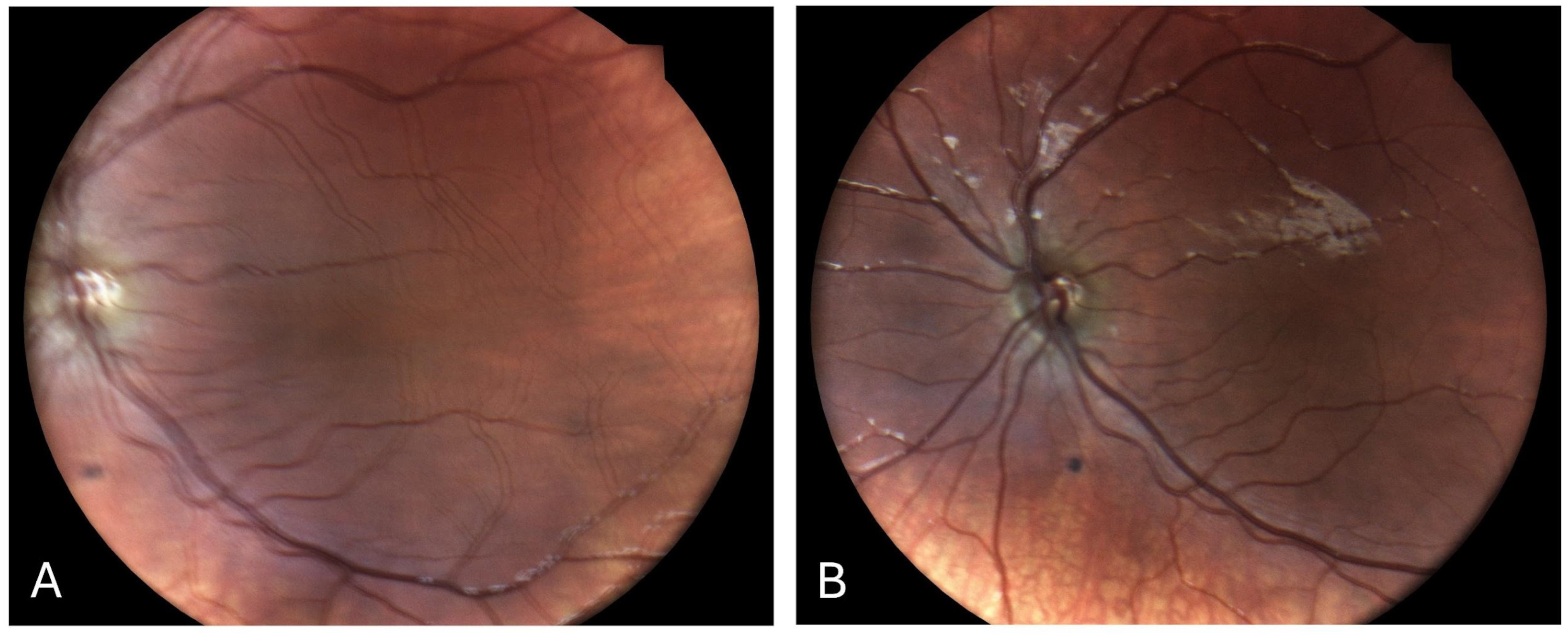 Children 12 00211 g001