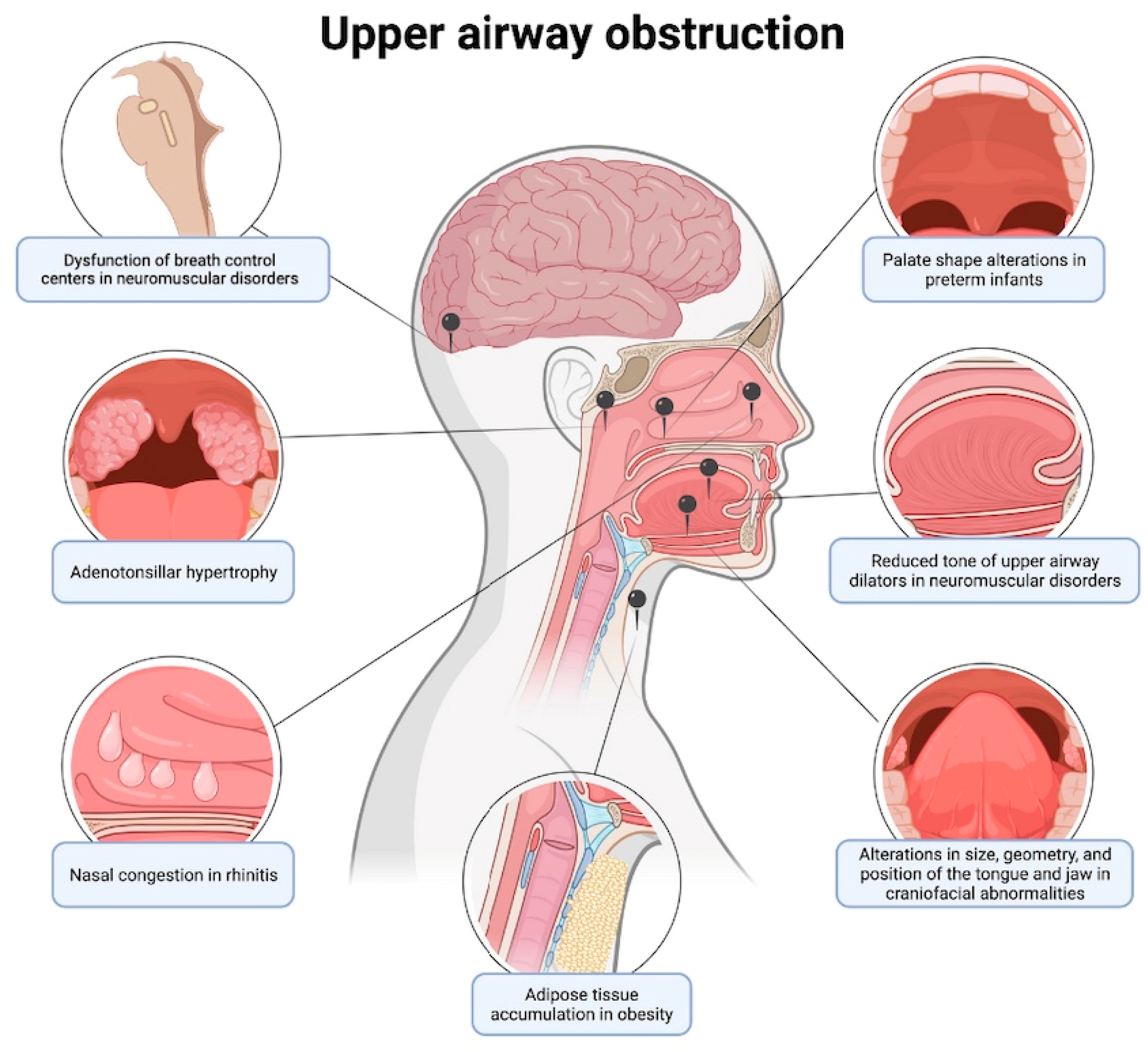 Children 12 00216 g002