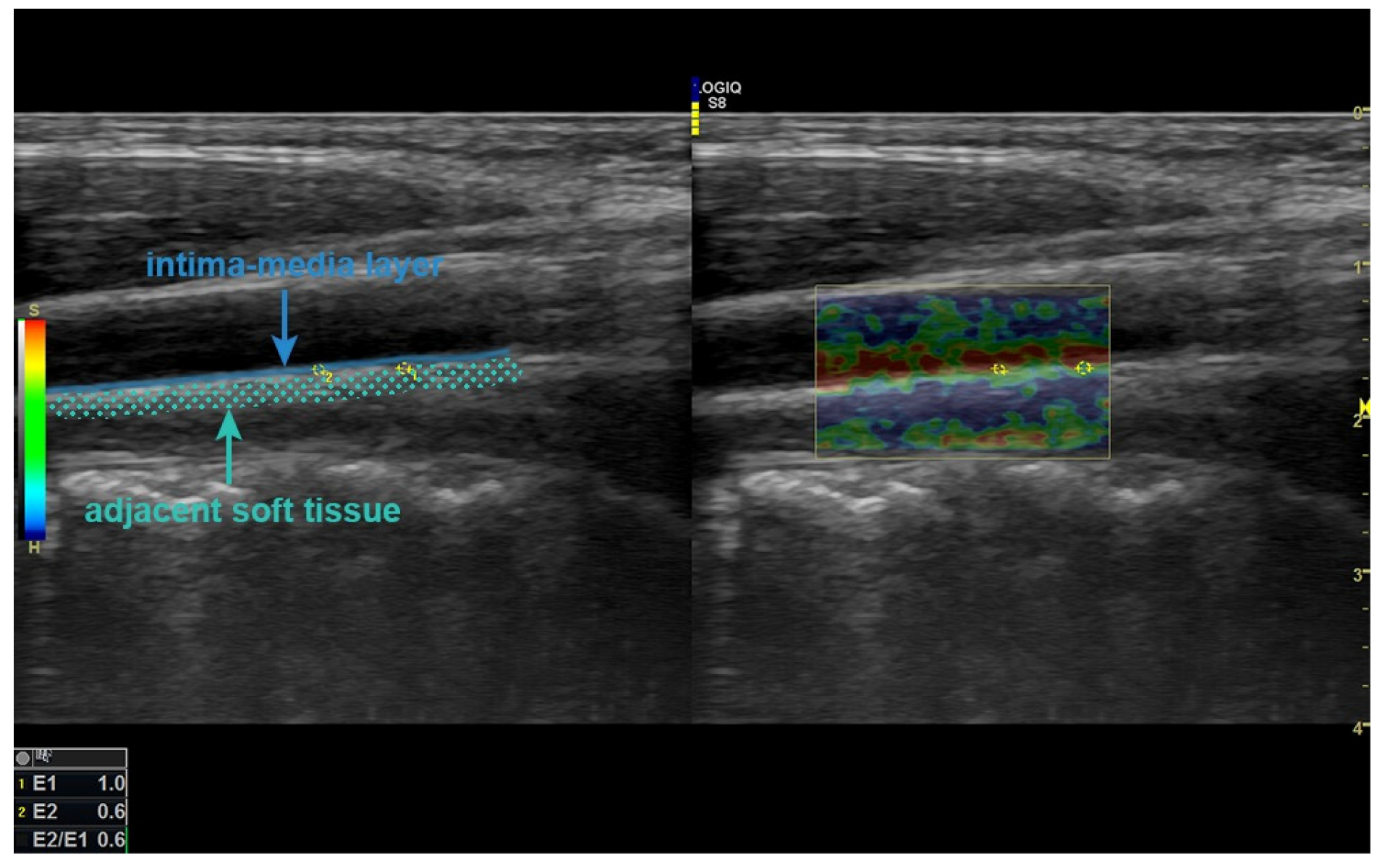 Children 12 00232 g001