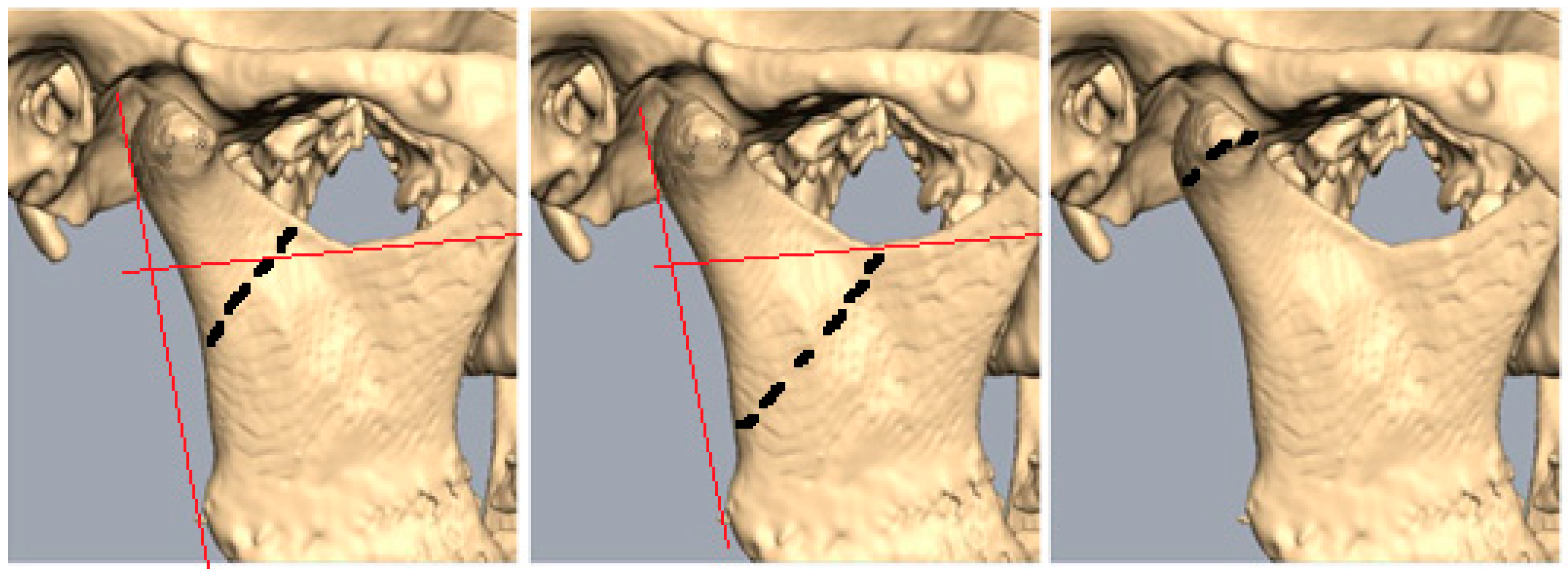 Children 12 00323 g001