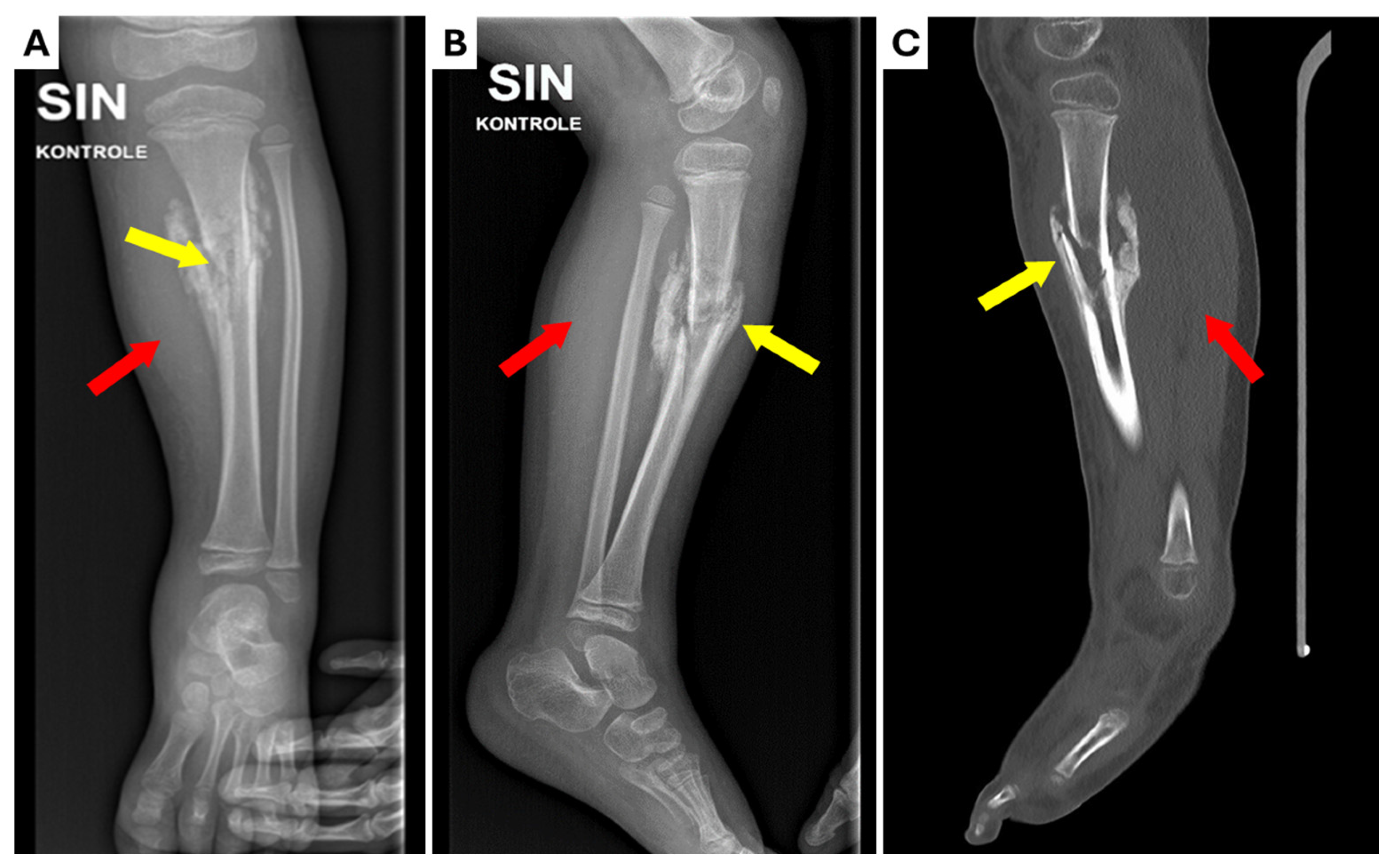 Children 12 00344 g001 Children 12 00344 g001