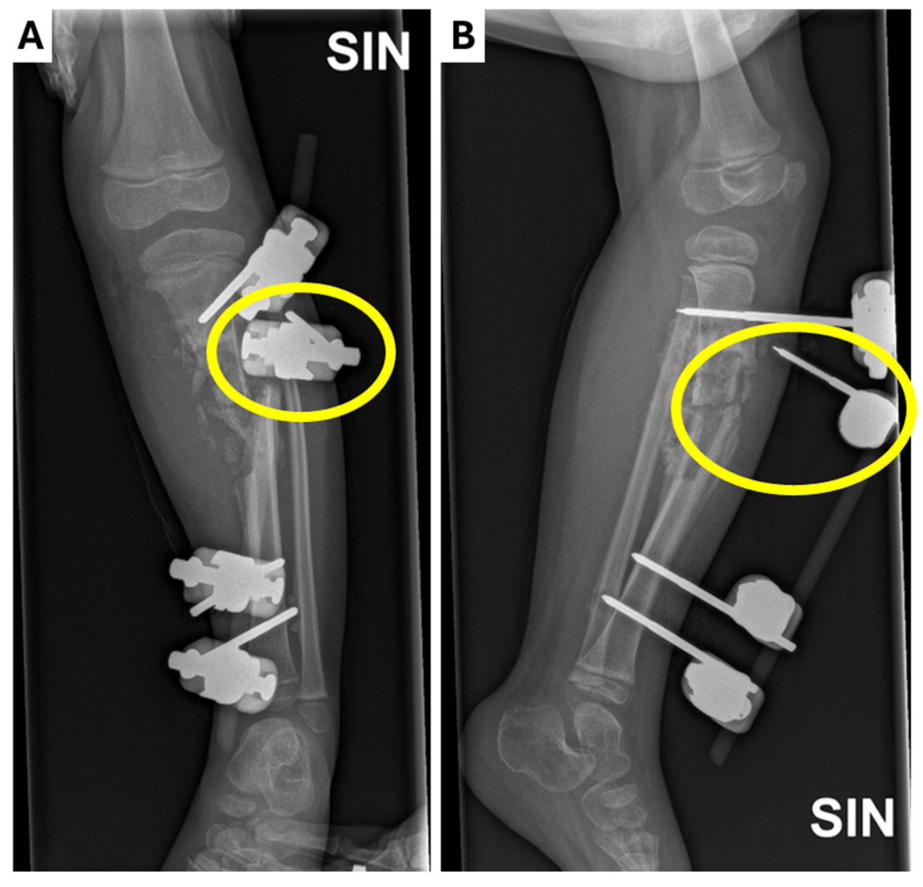 Children 12 00344 g003 Children 12 00344 g003