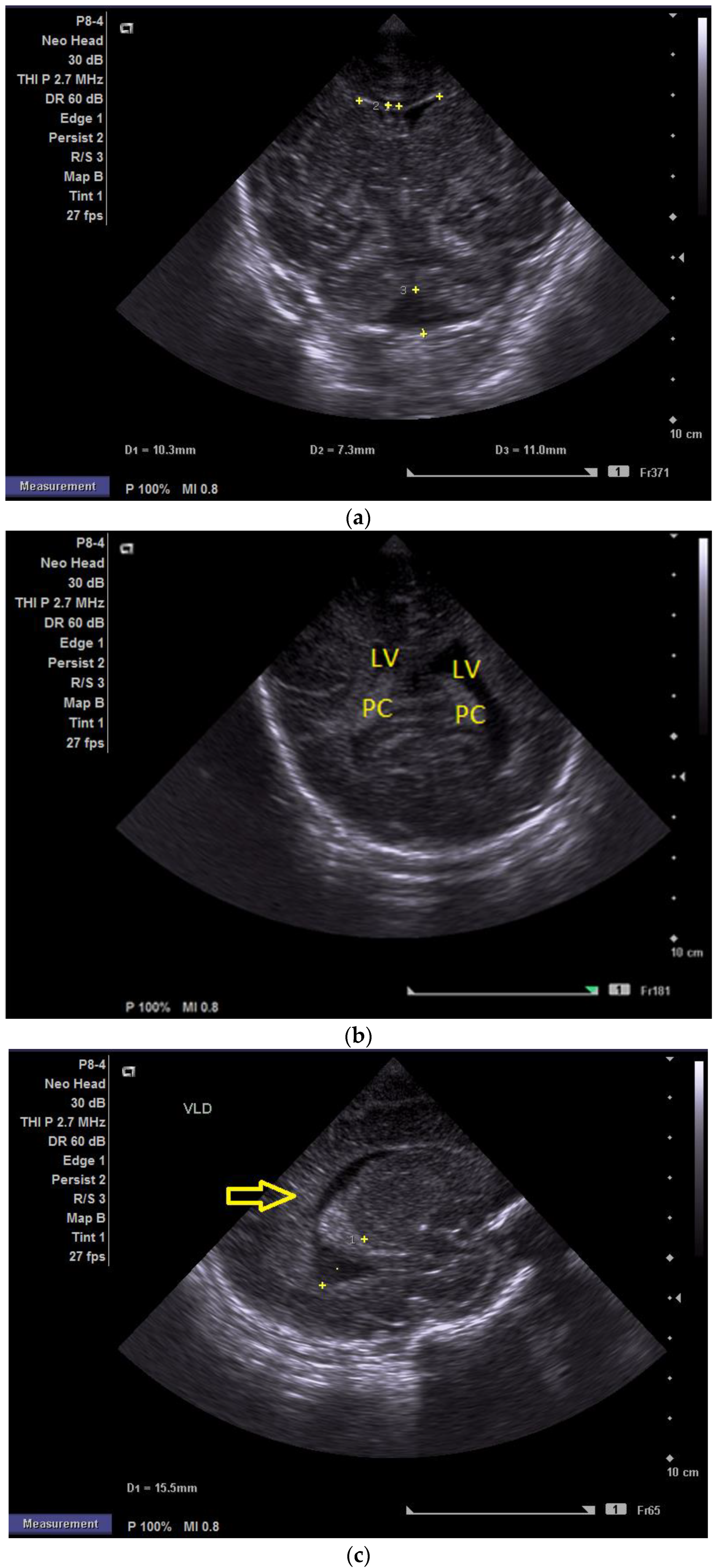 Children 12 00419 g001a