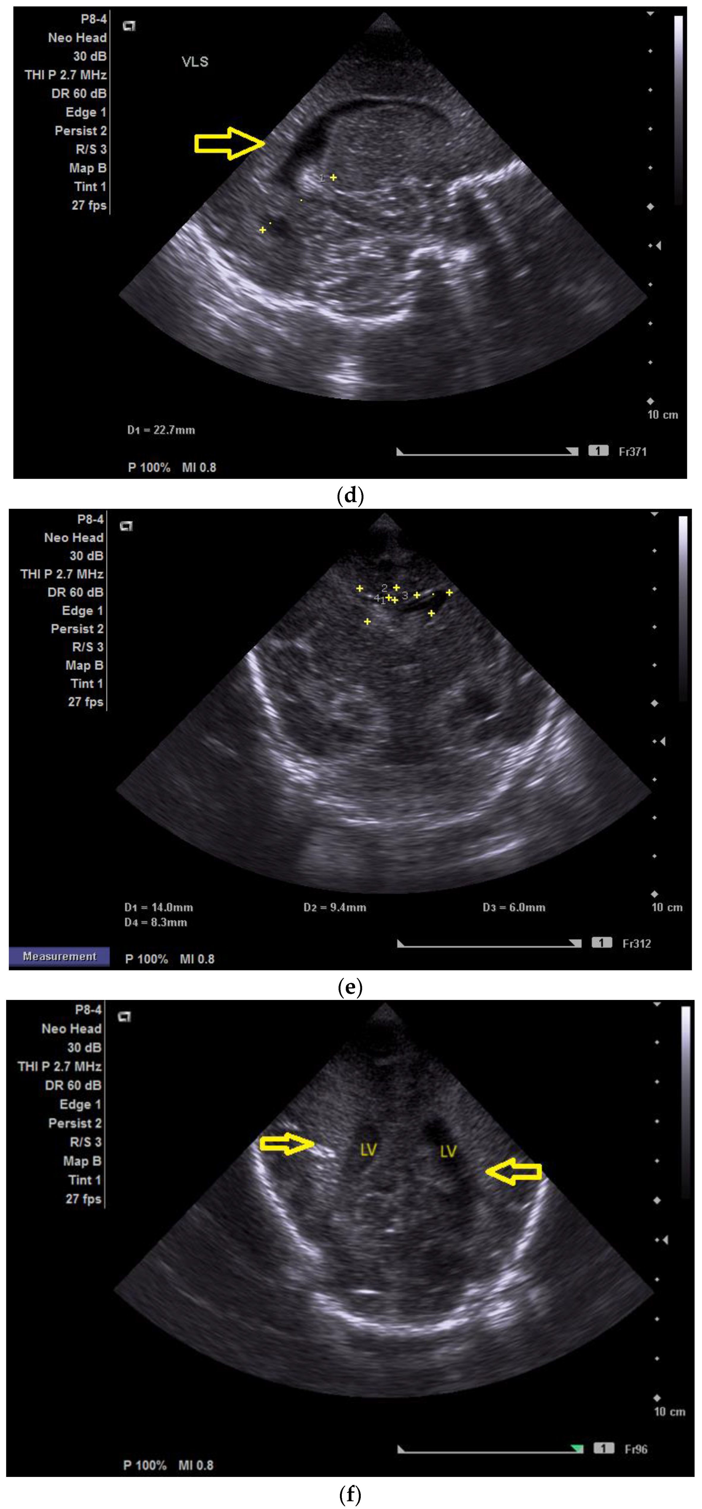 Children 12 00419 g001b