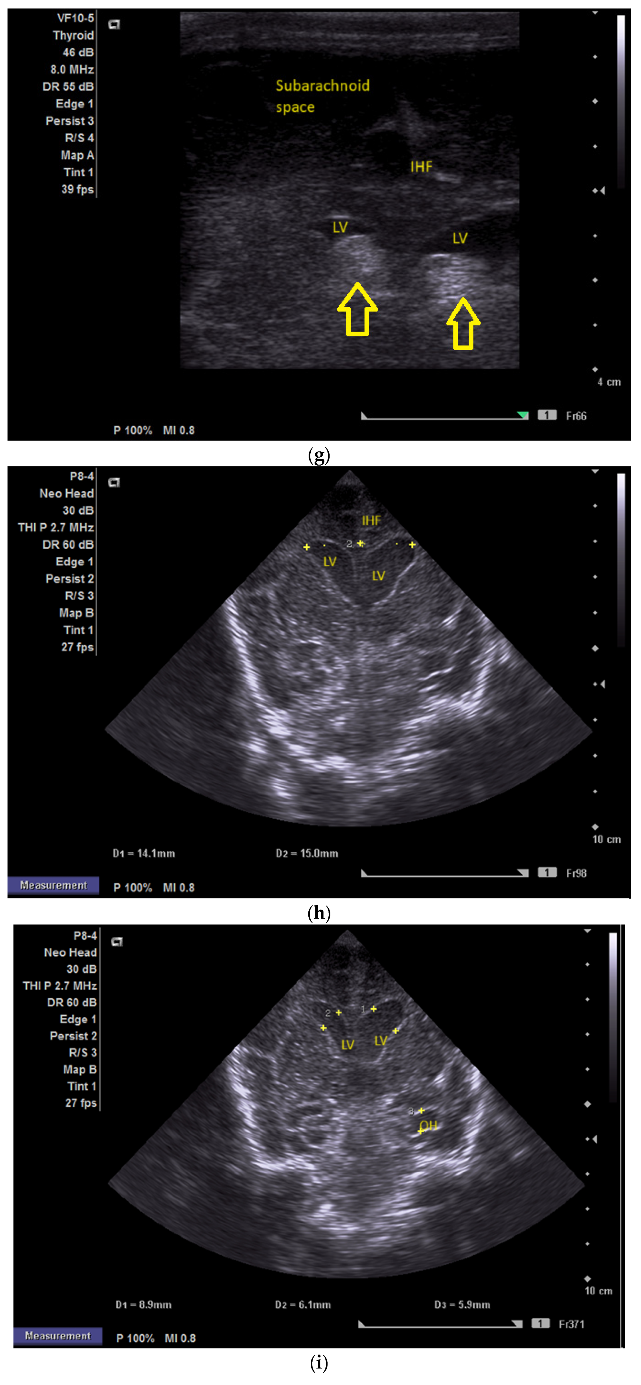 Children 12 00419 g001c