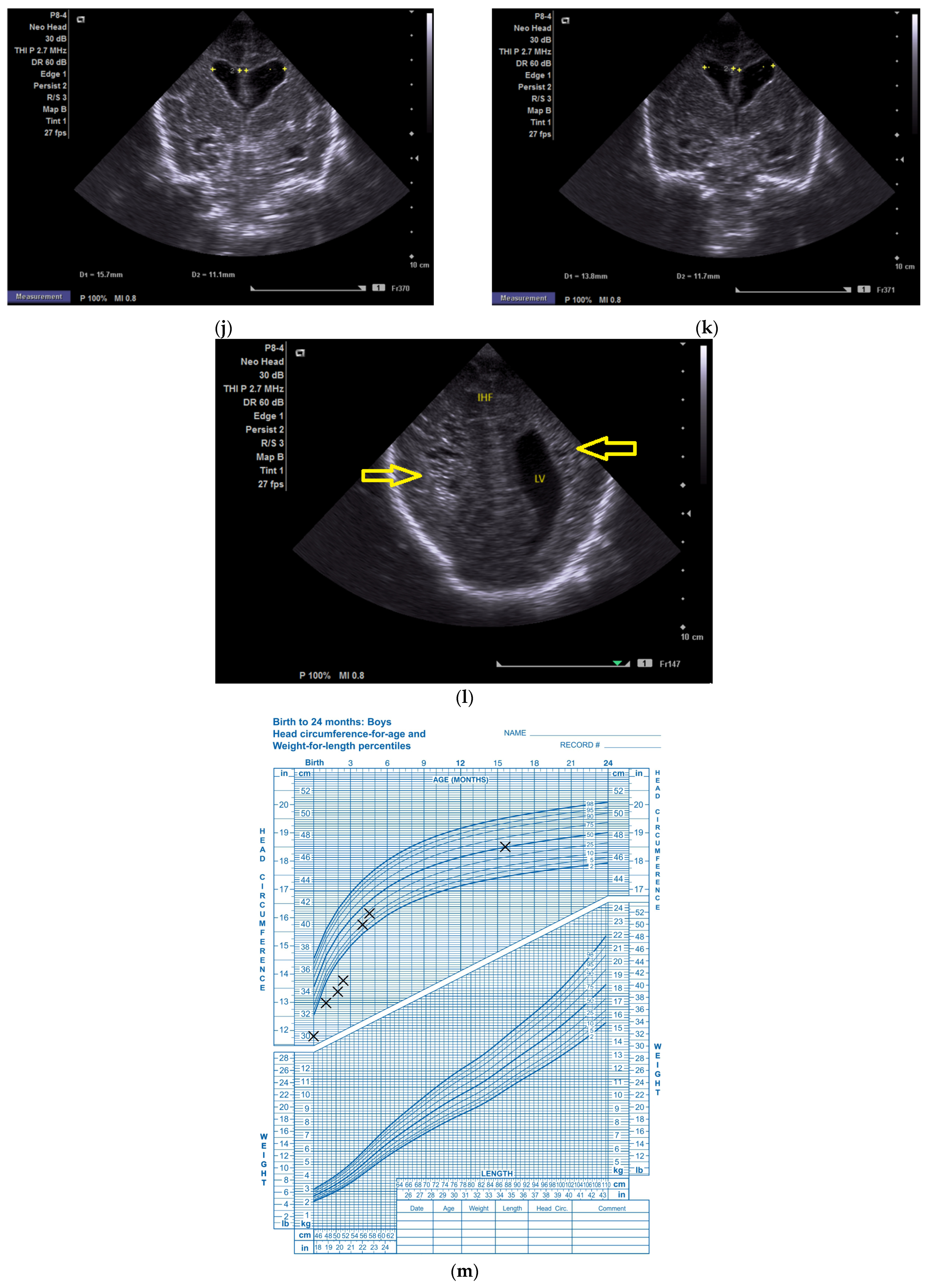 Children 12 00419 g001d
