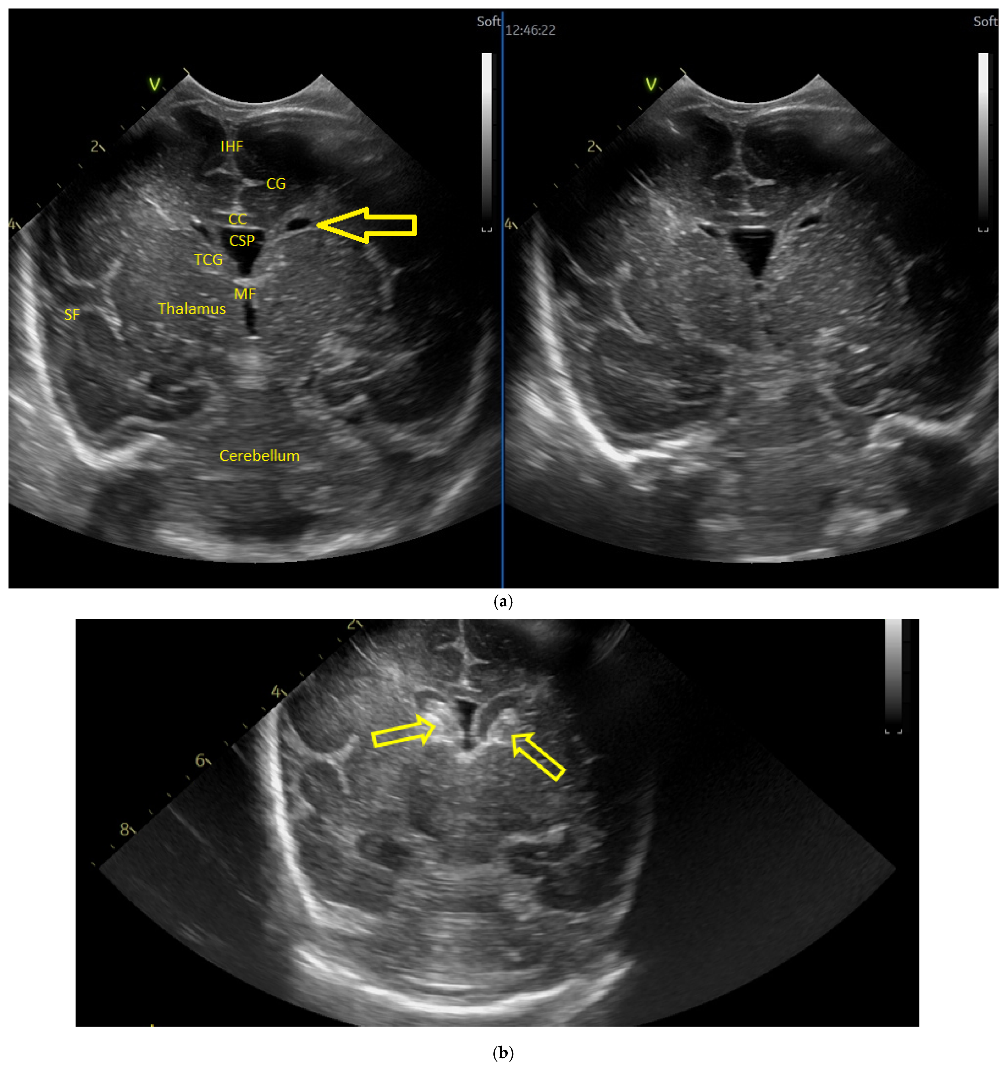 Children 12 00419 g002a