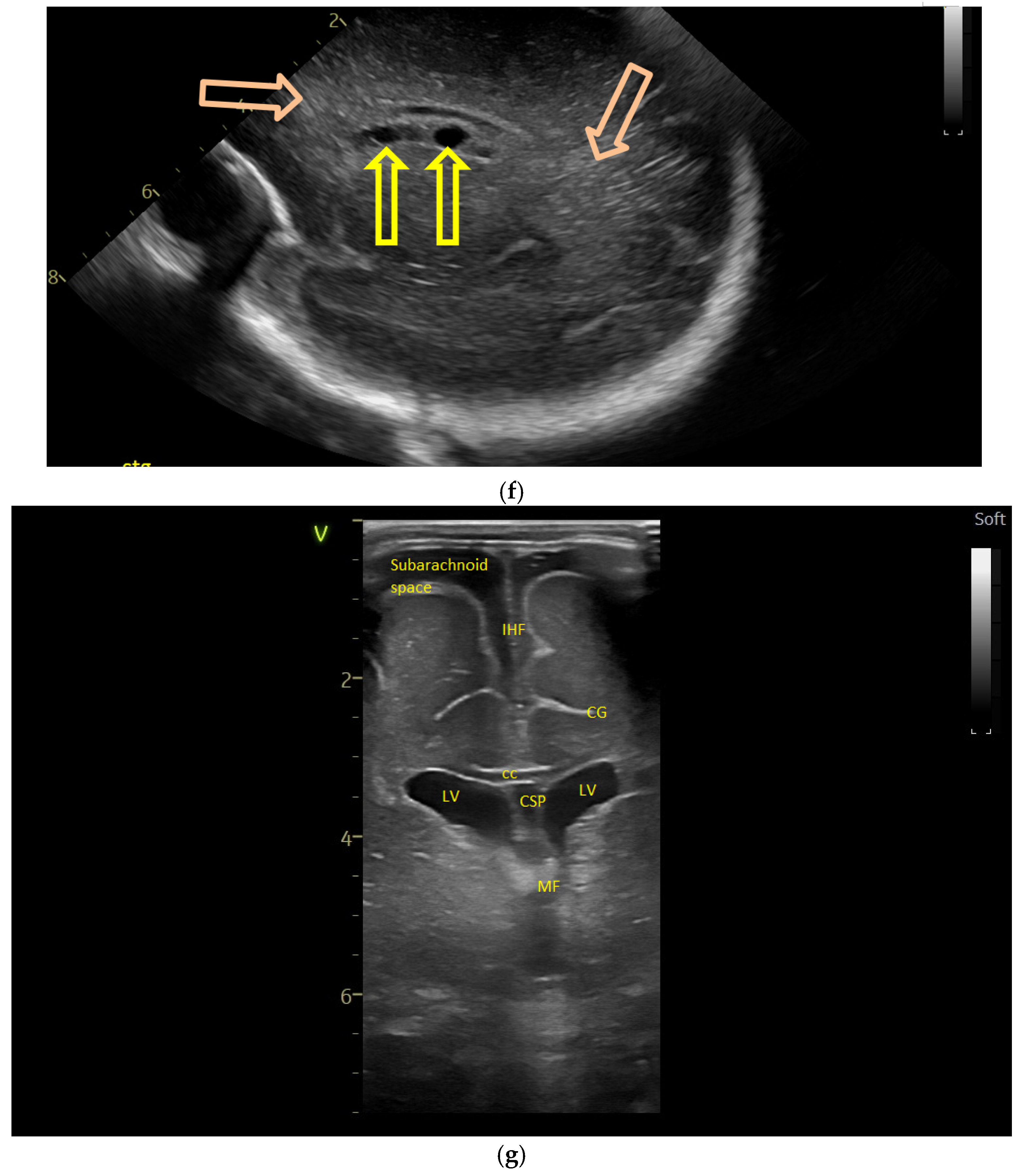 Children 12 00419 g002c