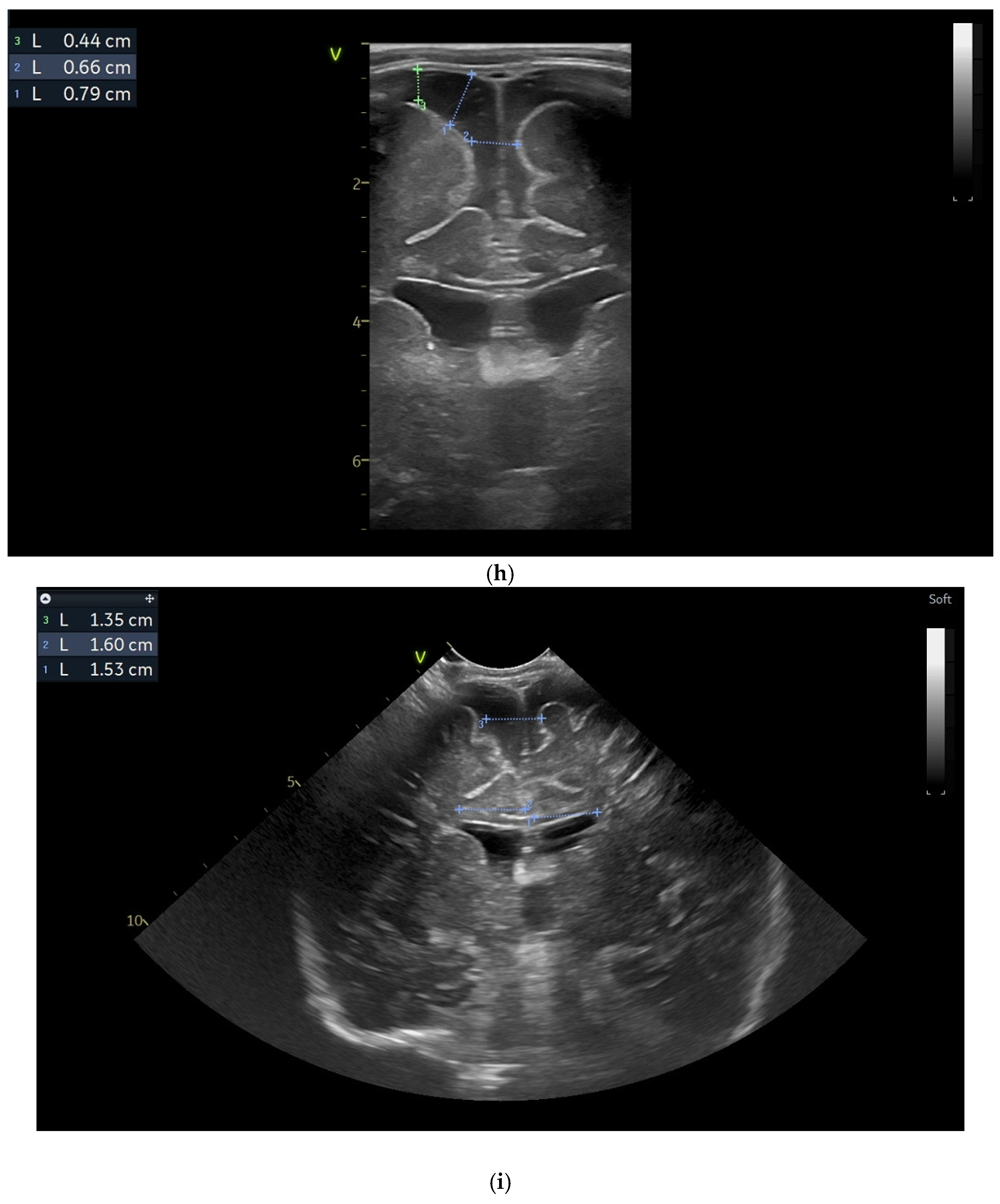 Children 12 00419 g002d