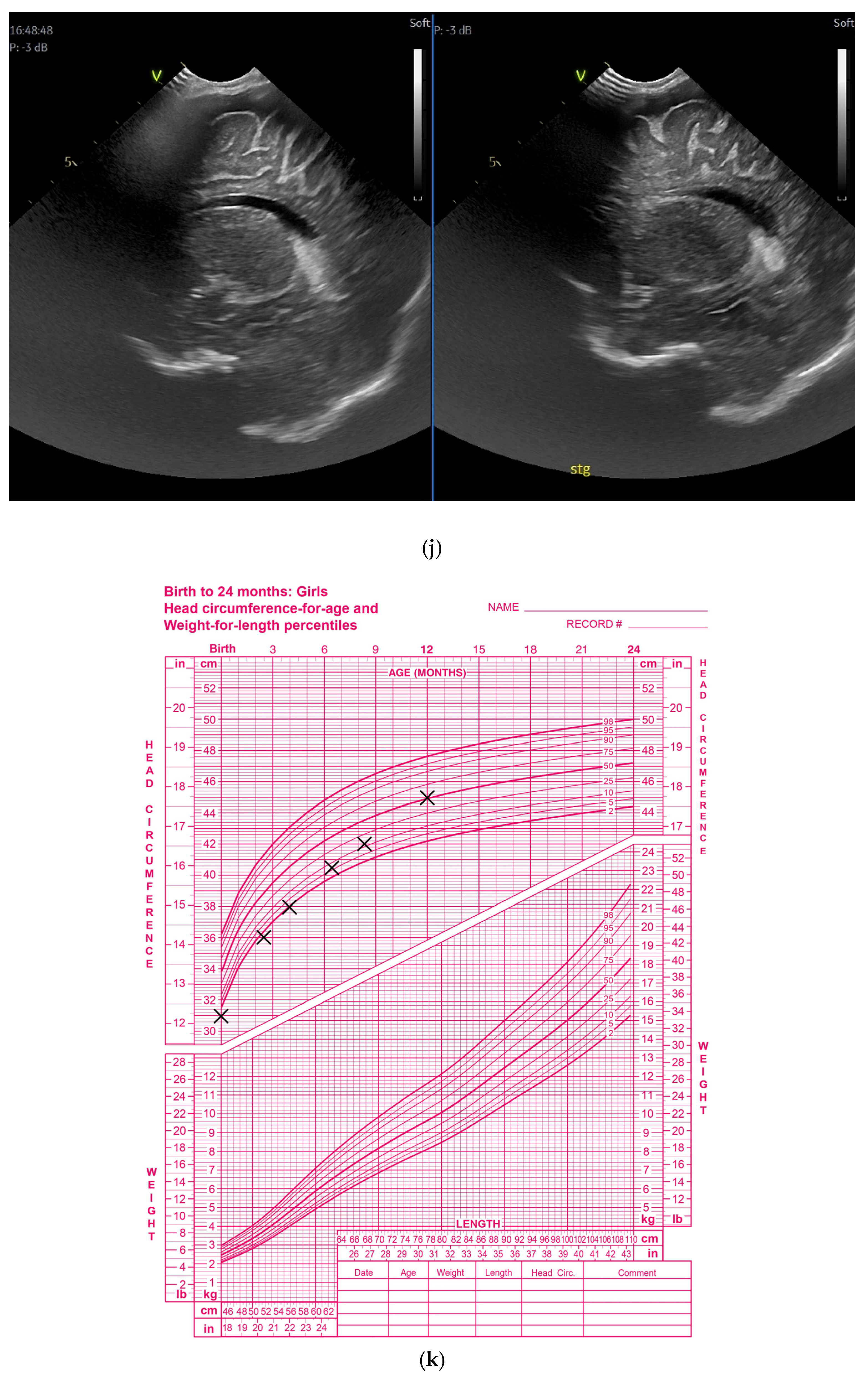Children 12 00419 g002e