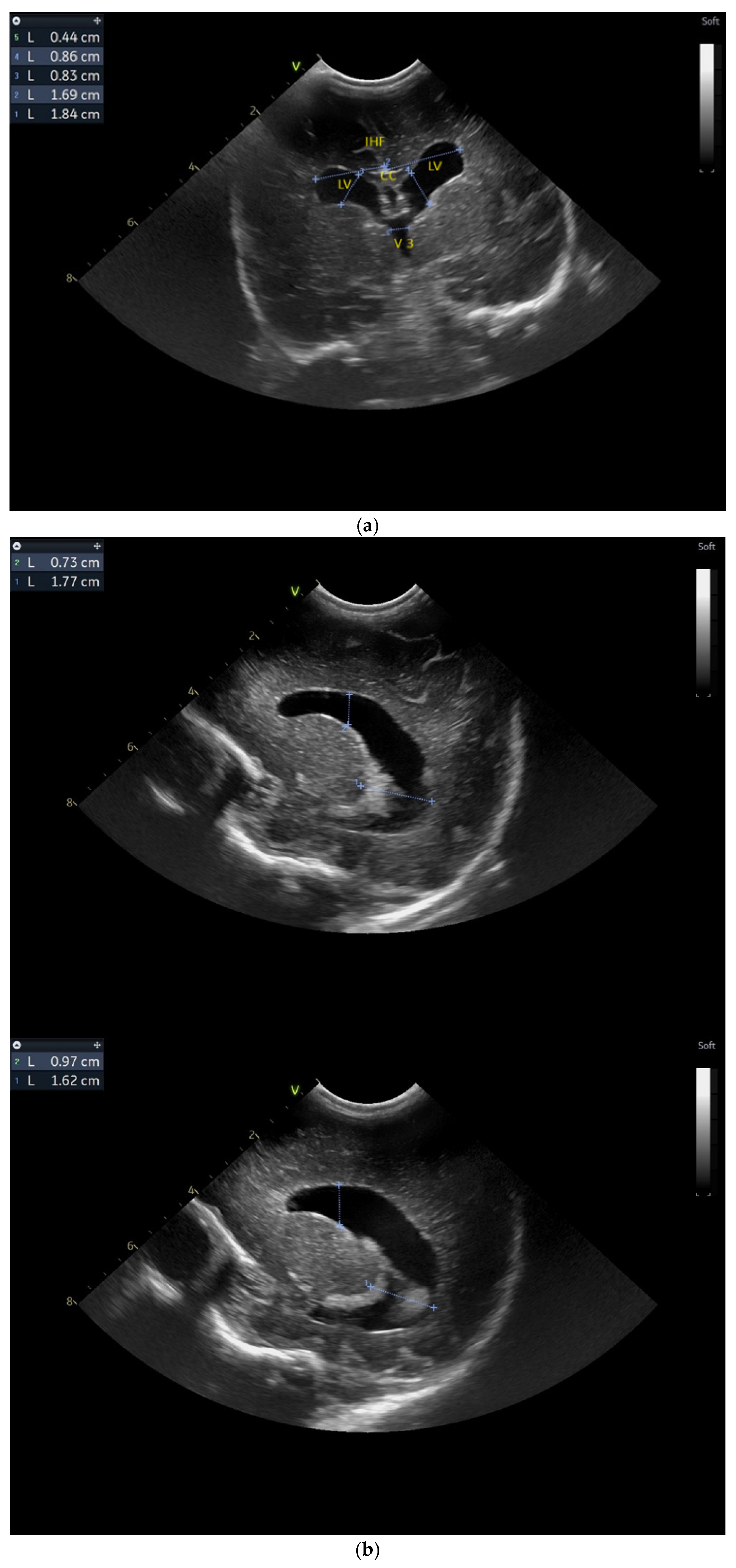 Children 12 00419 g003a