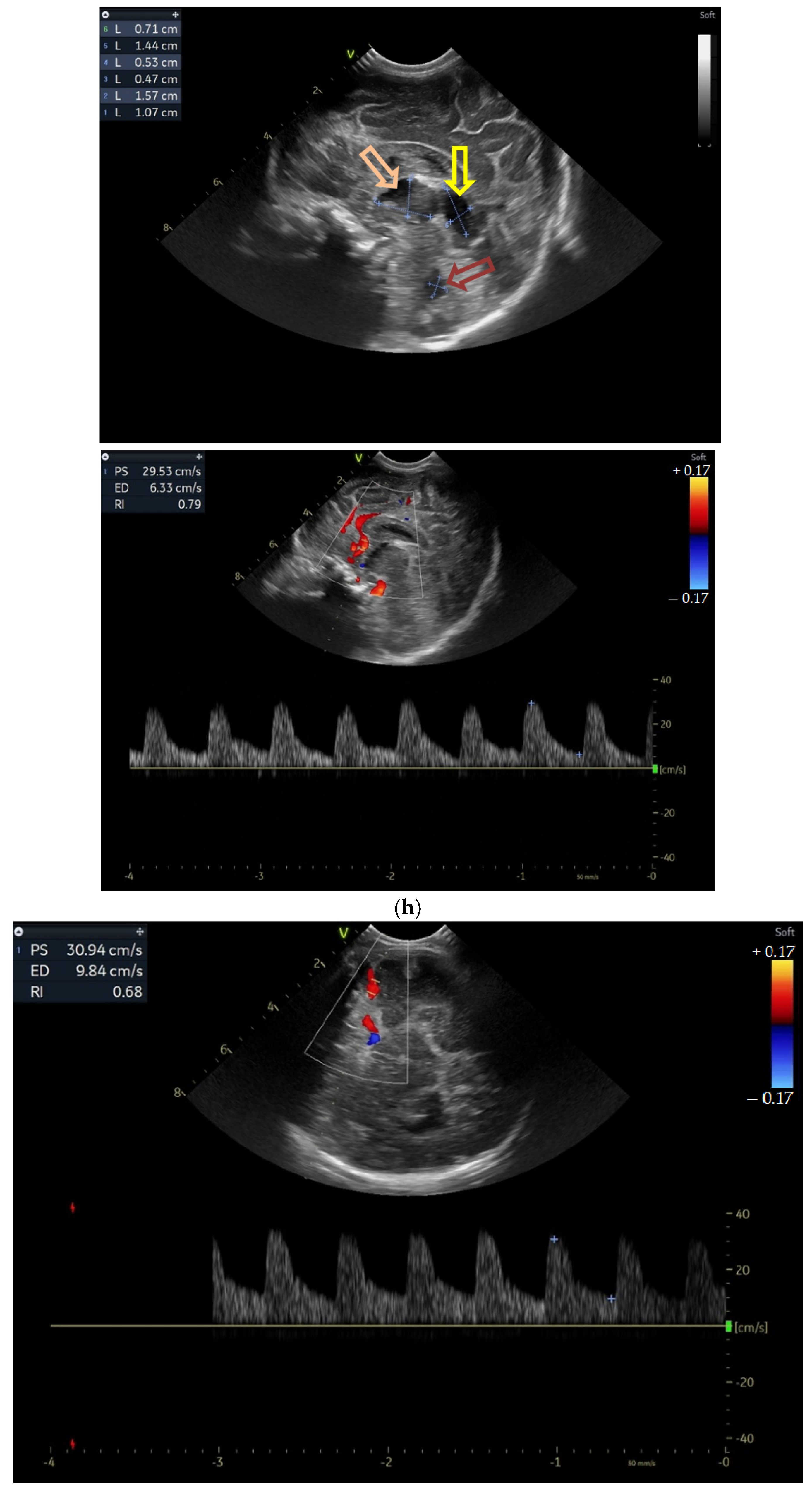 Children 12 00419 g003d