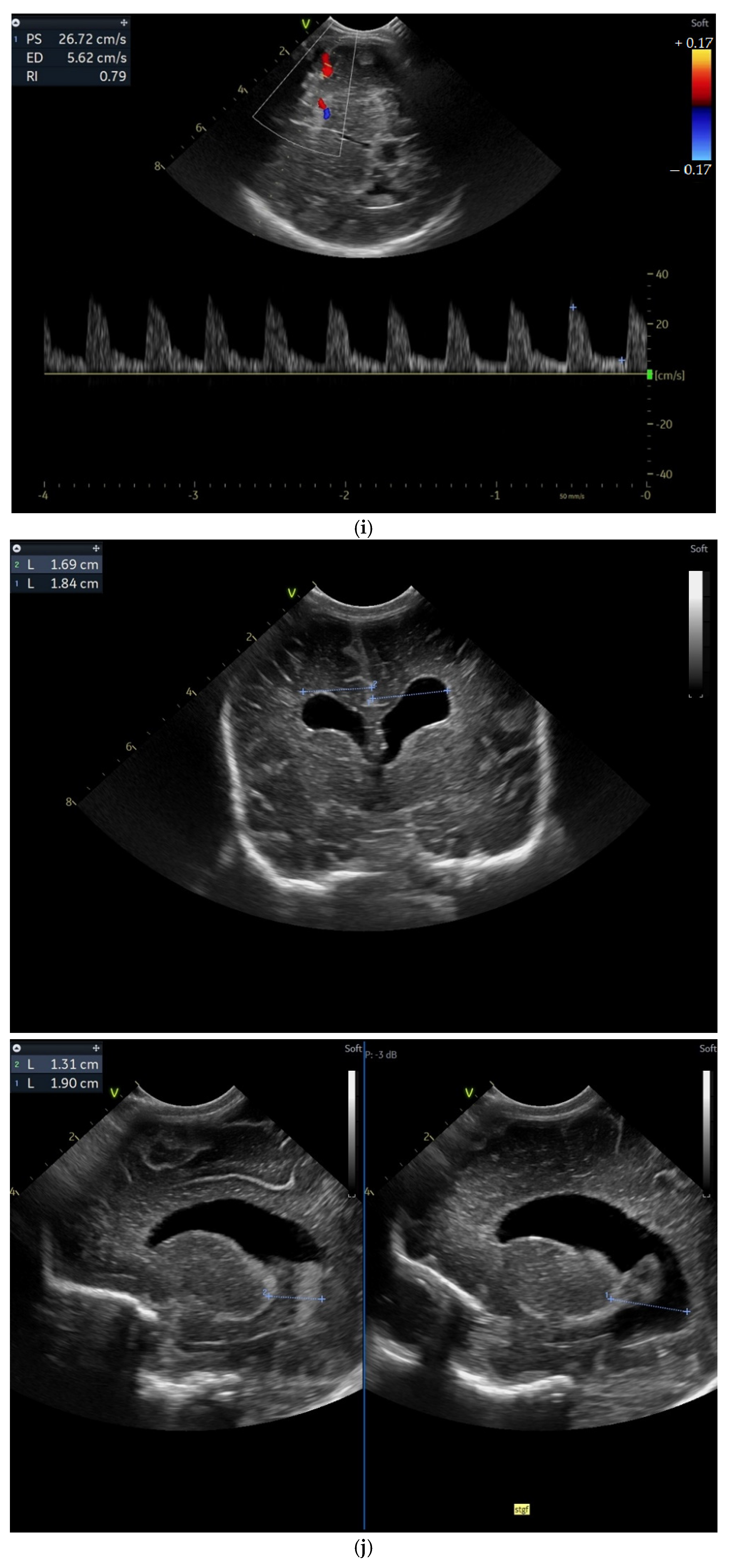 Children 12 00419 g003e