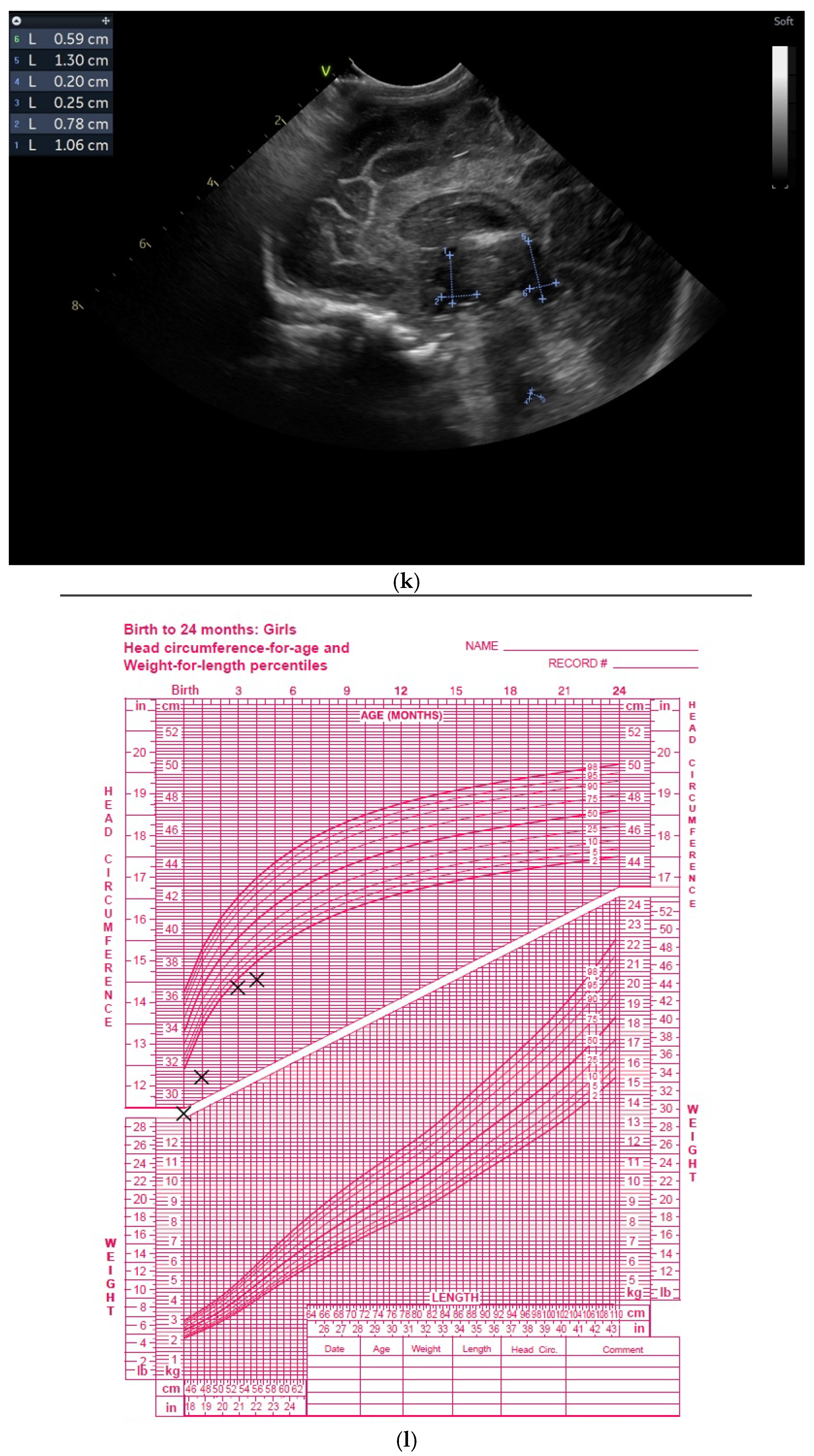 Children 12 00419 g003f