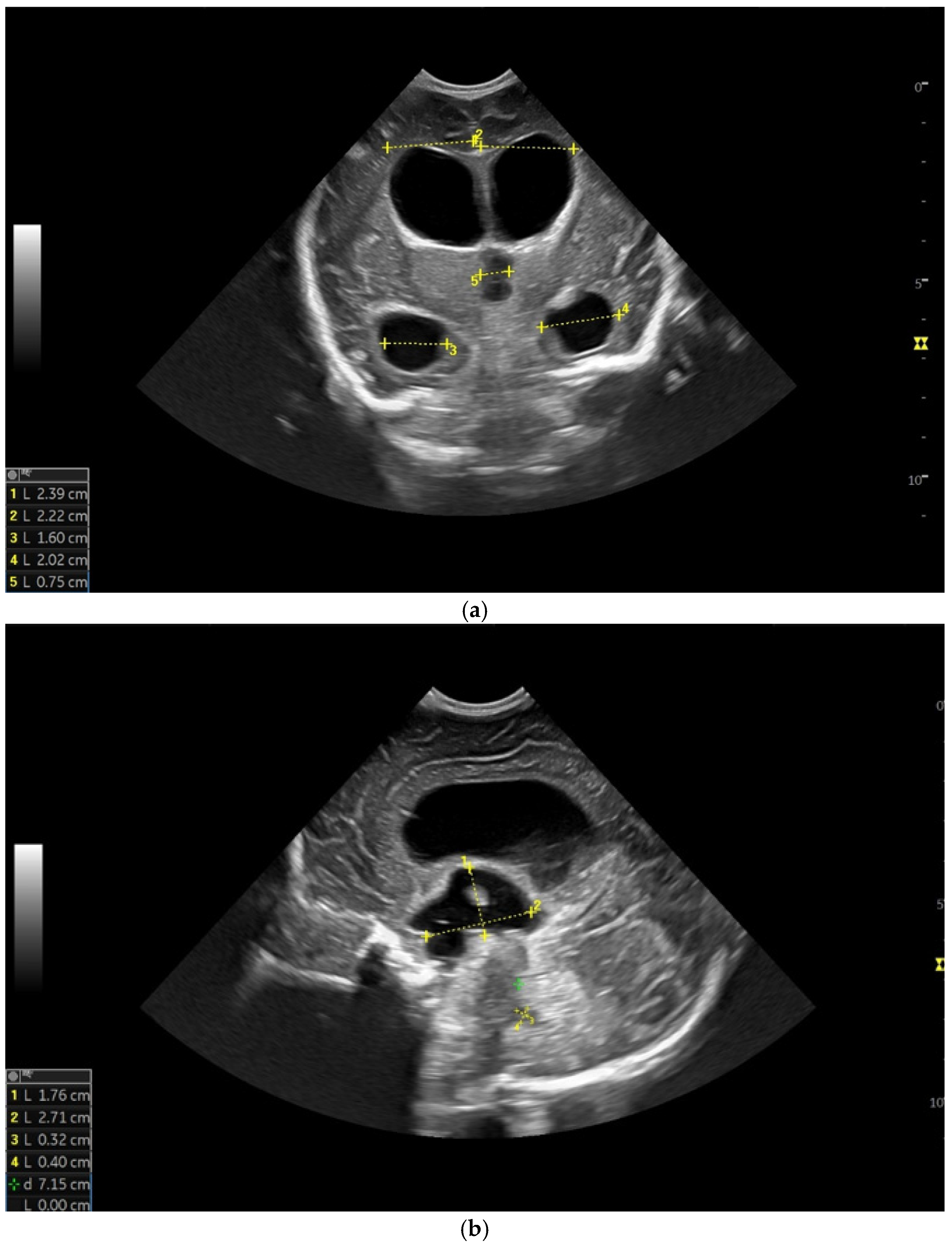 Children 12 00419 g004a