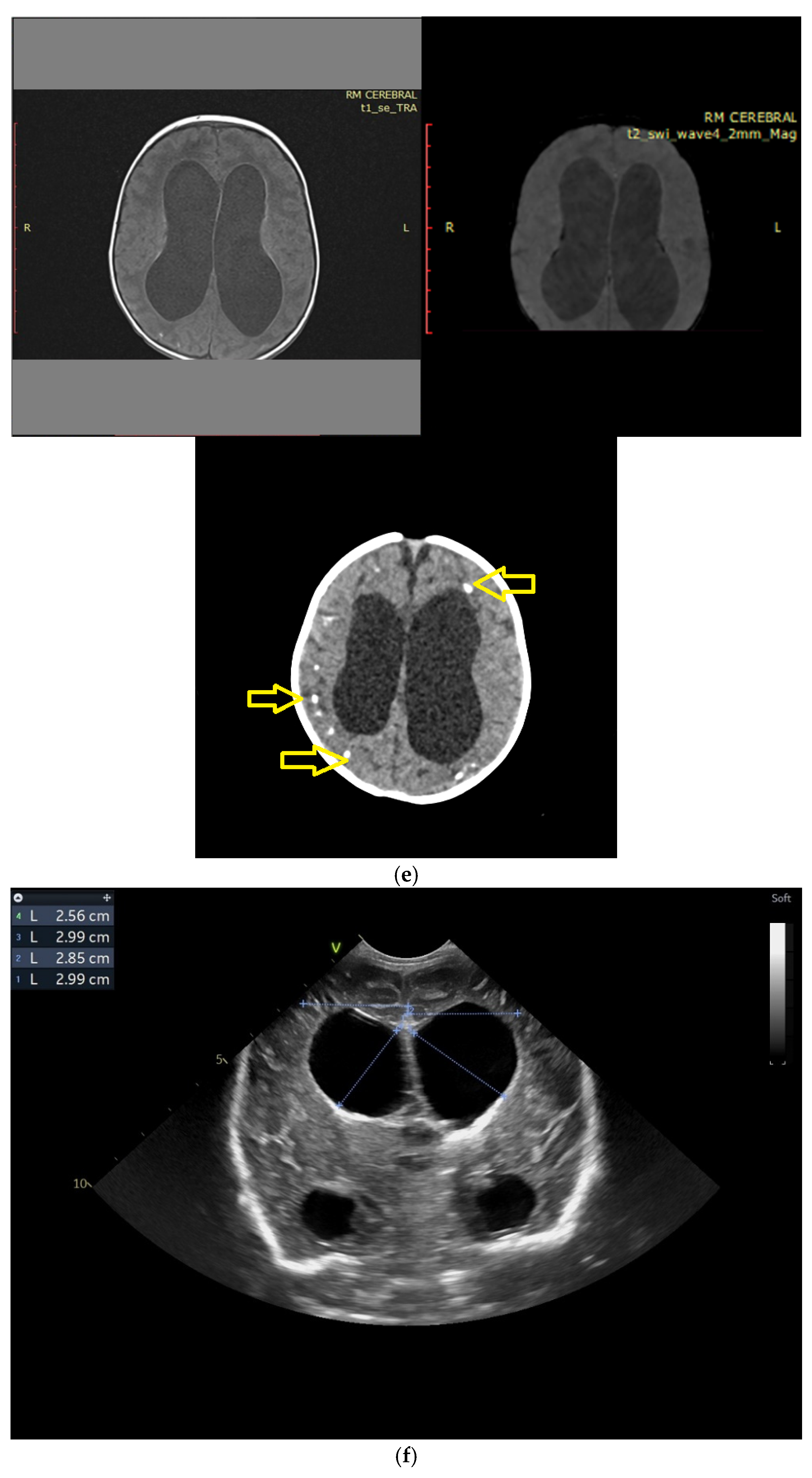 Children 12 00419 g004c