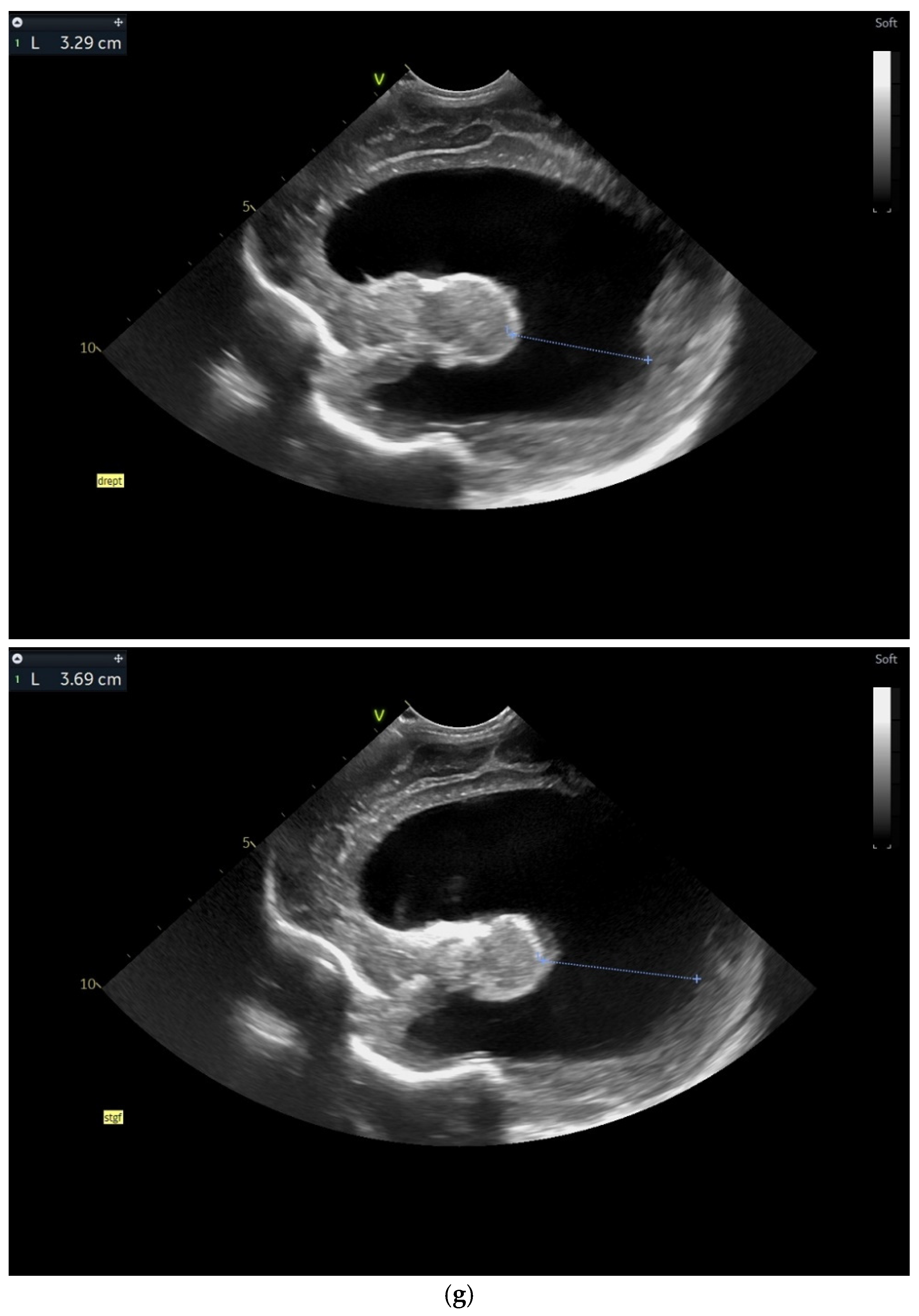 Children 12 00419 g004d