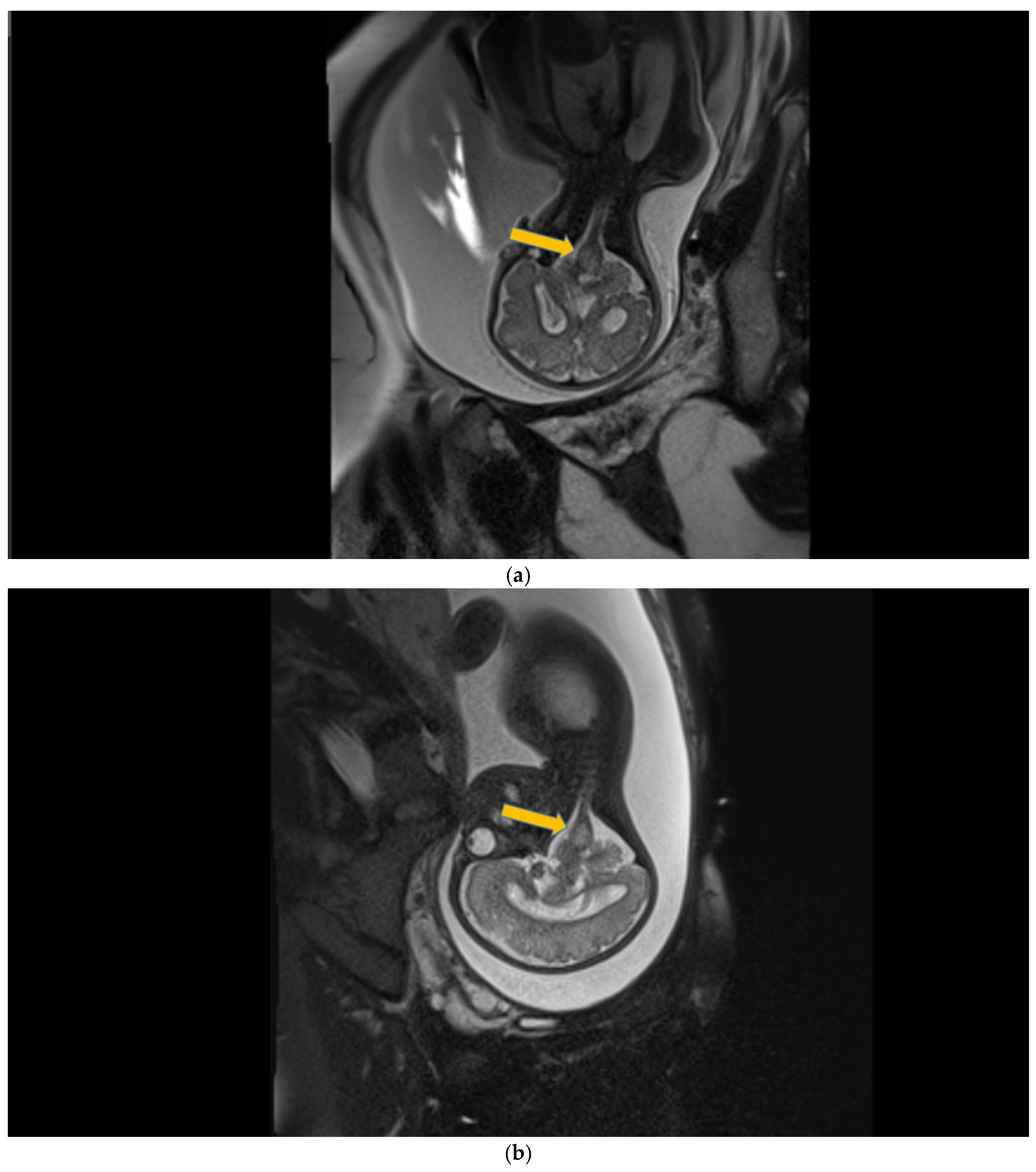Children 12 00419 g005a