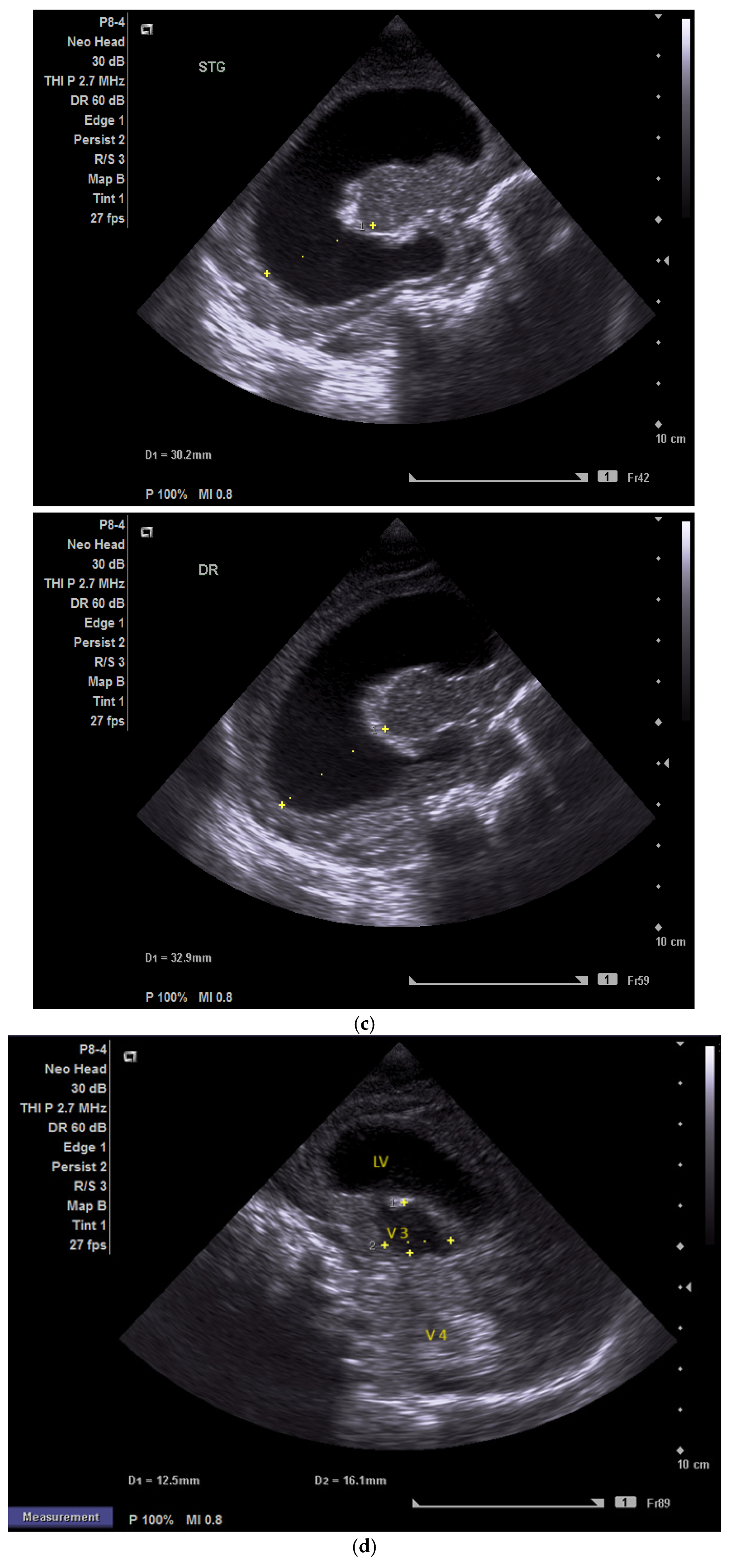 Children 12 00419 g005b