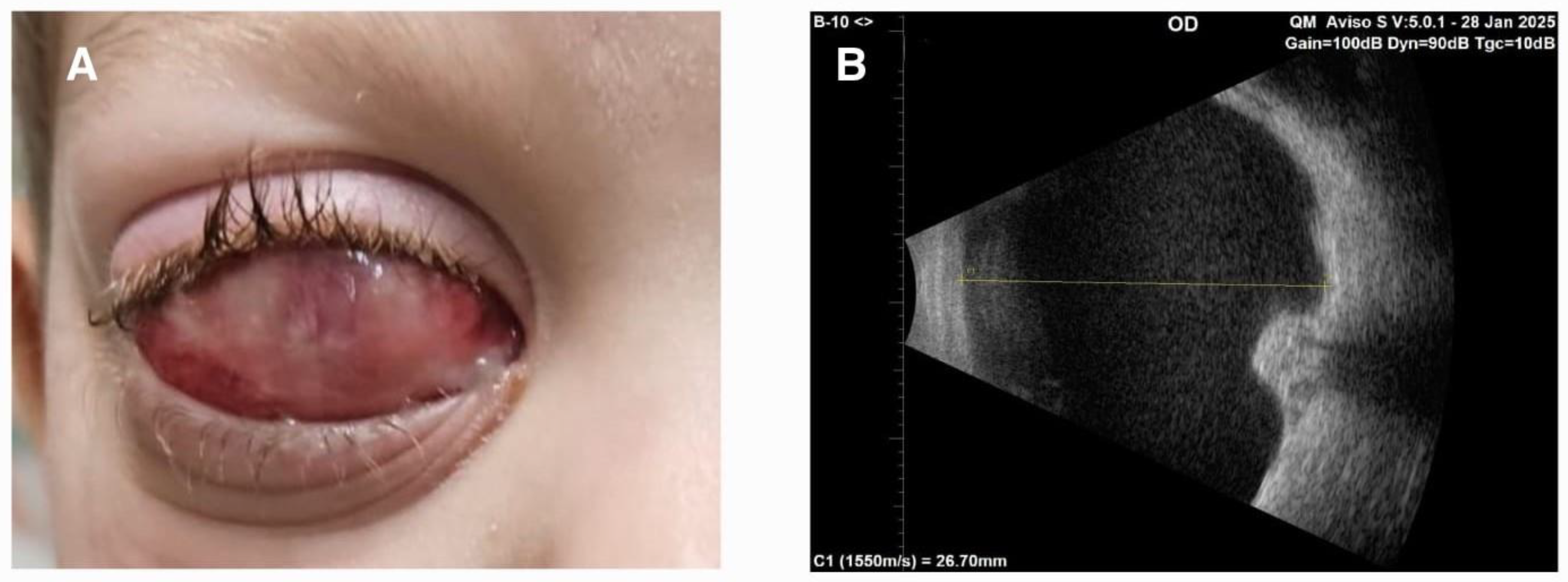 Children 12 00457 g002