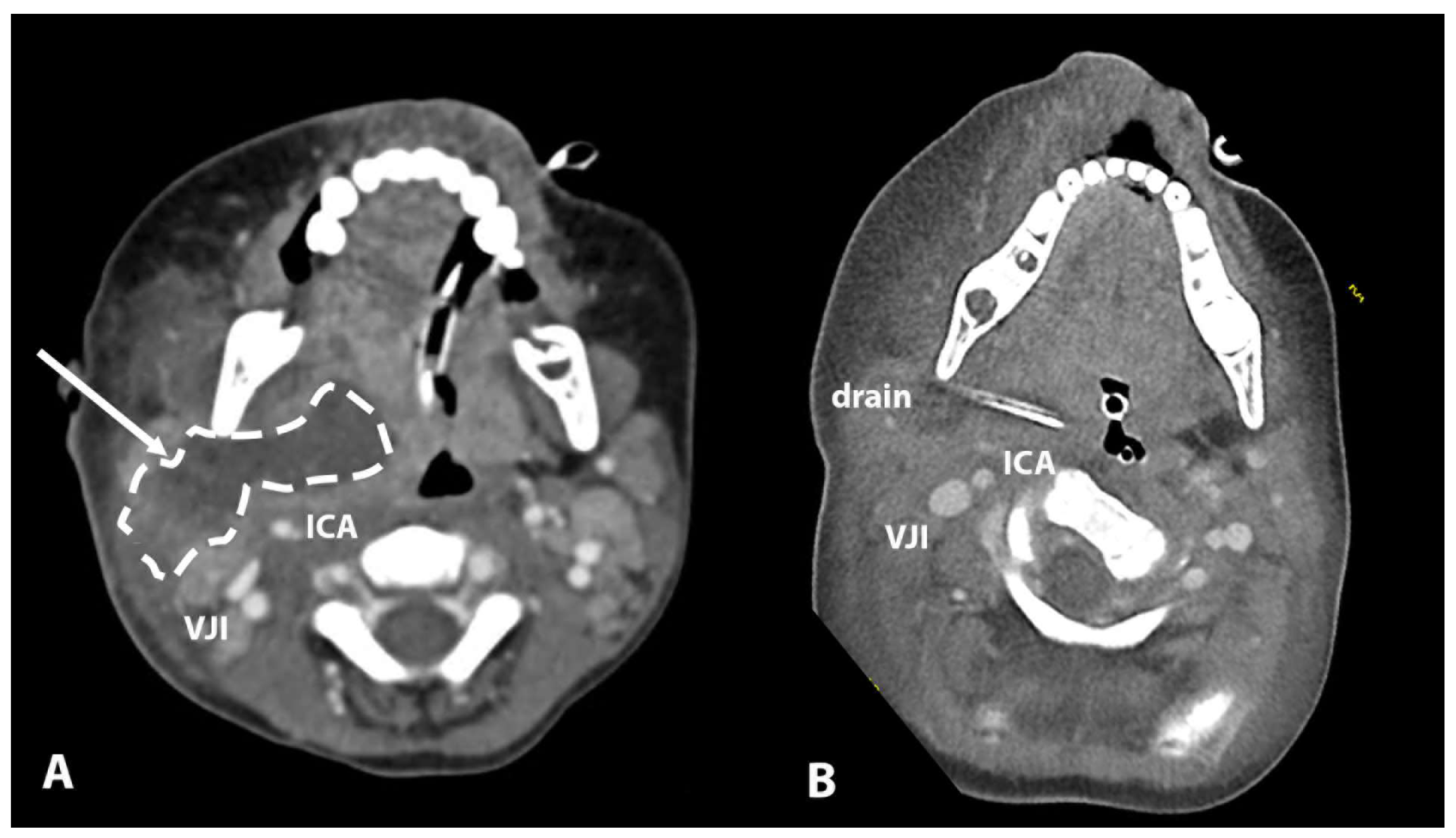 Children 12 00487 g002