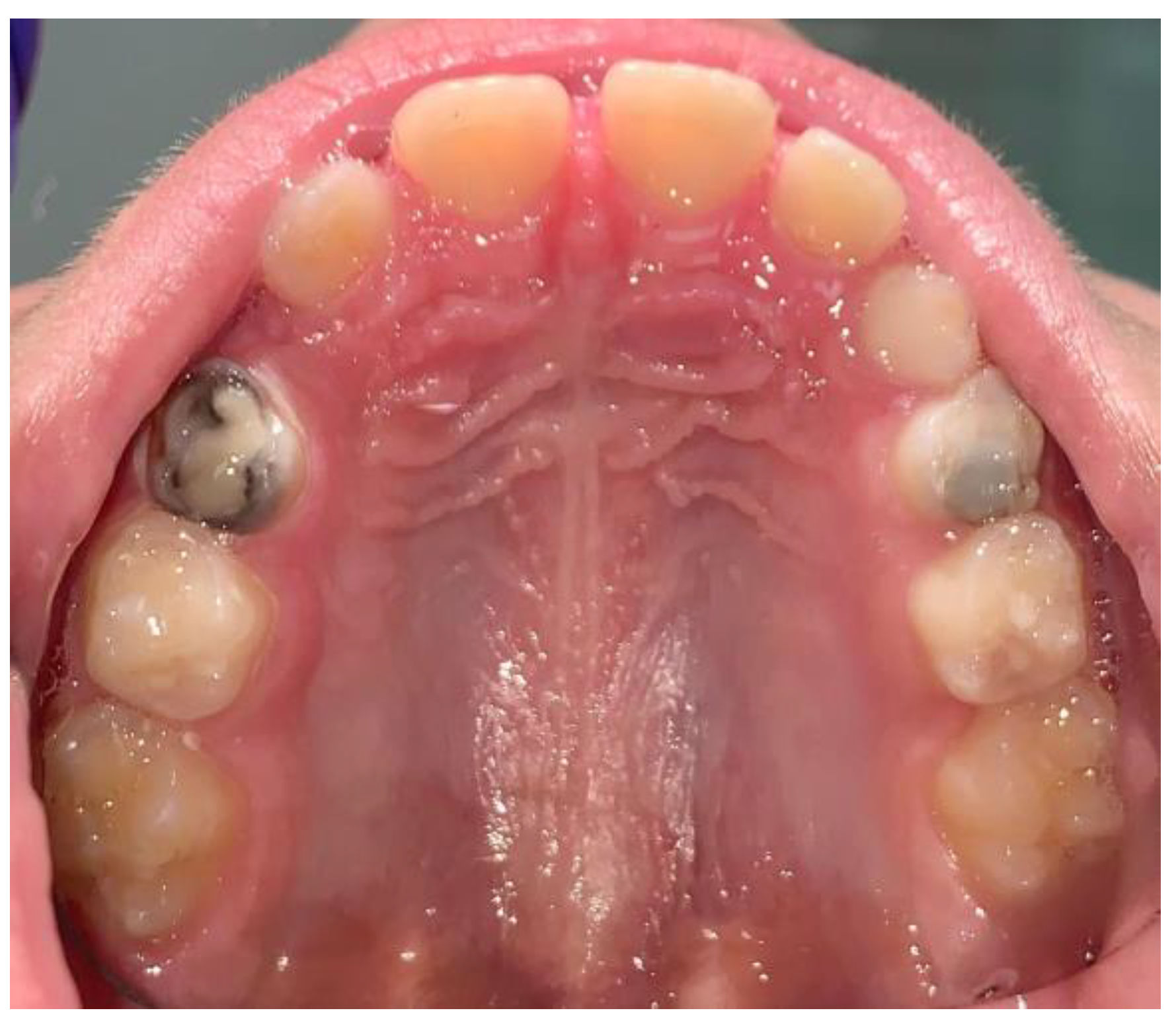 Children 12 00511 g003