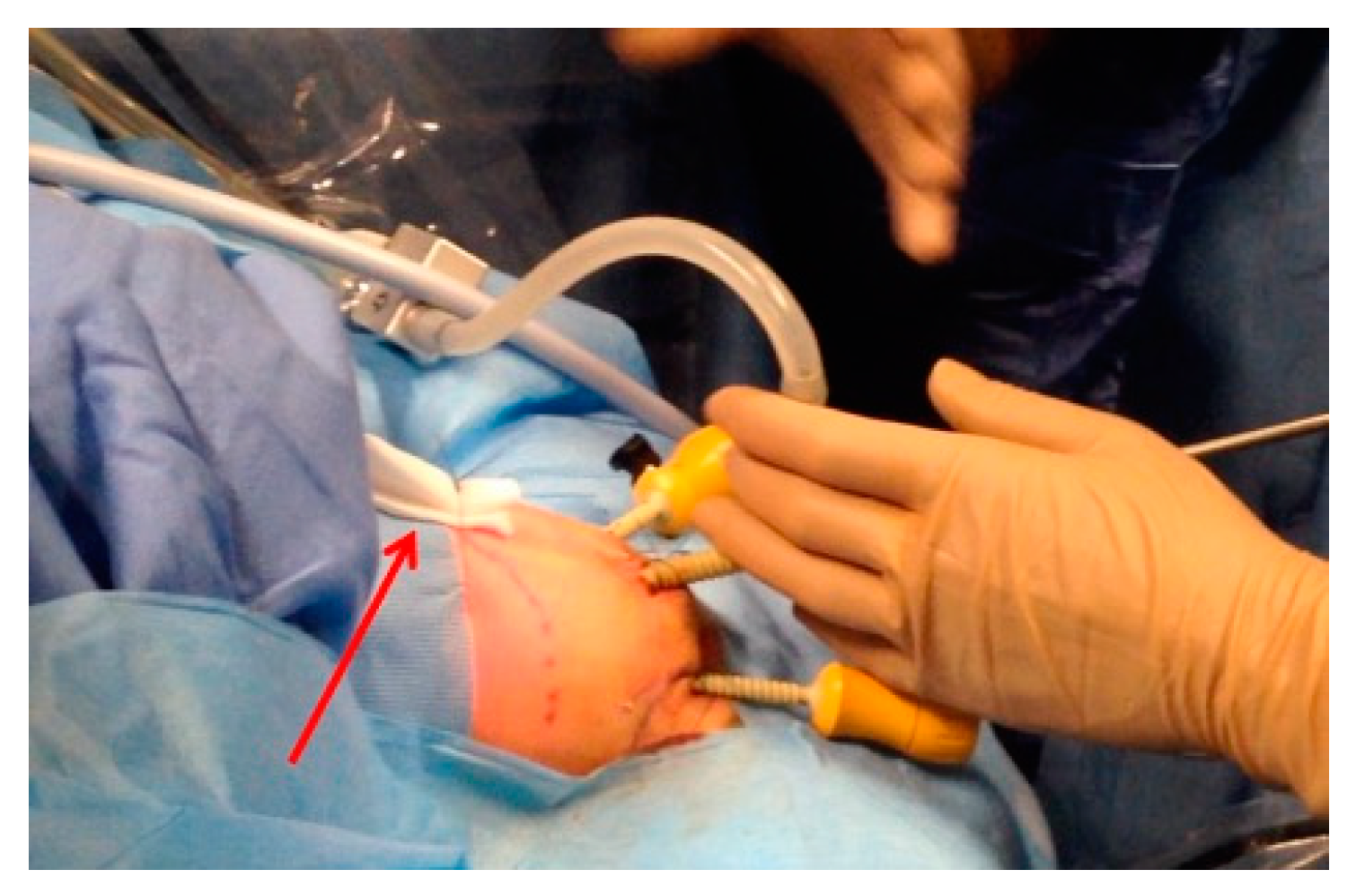 Children 12 00517 g003